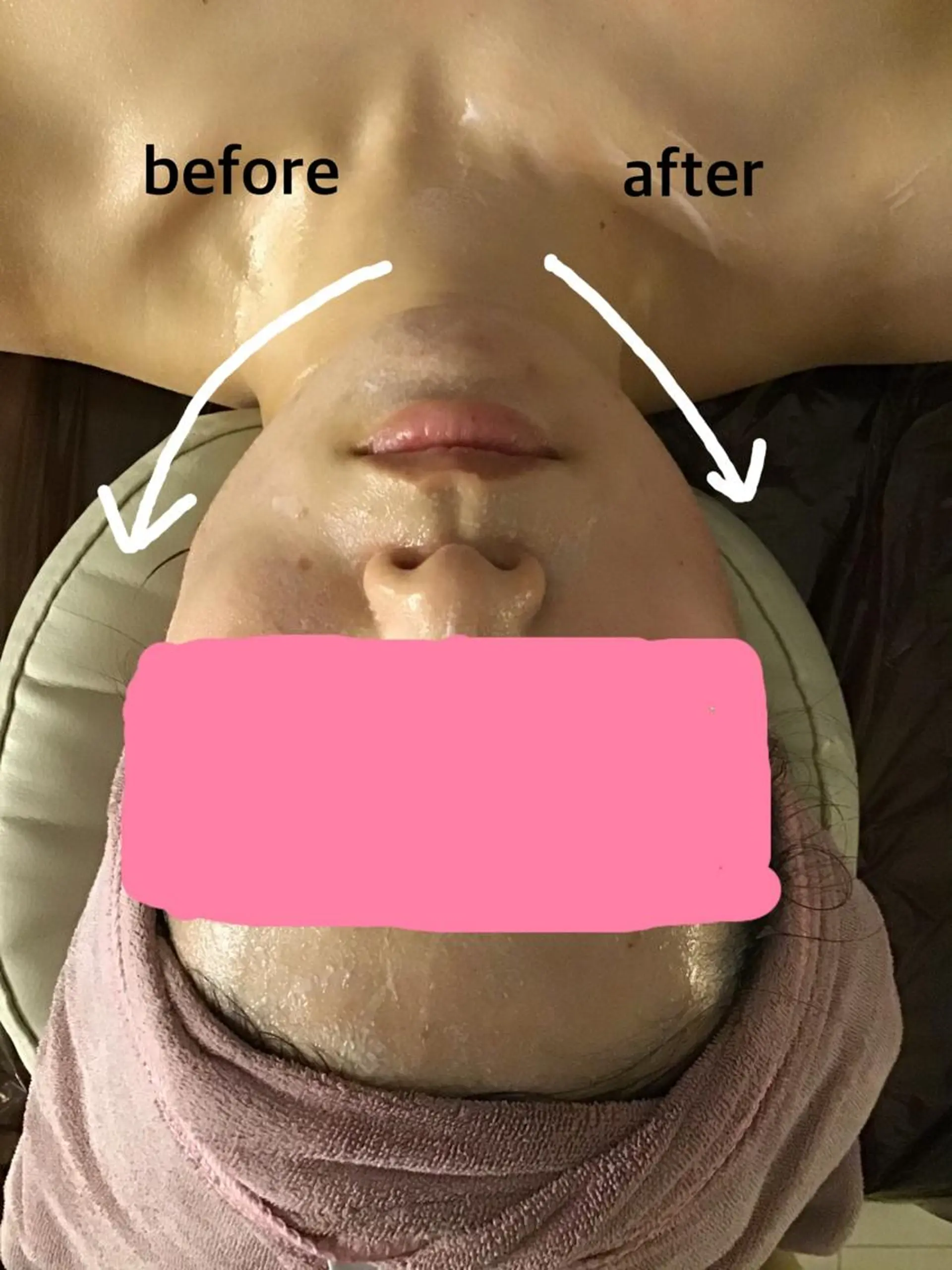 エステ リラク BELLEFINE 💕痩身・小顔・脱毛のエステ・リラクイメージ