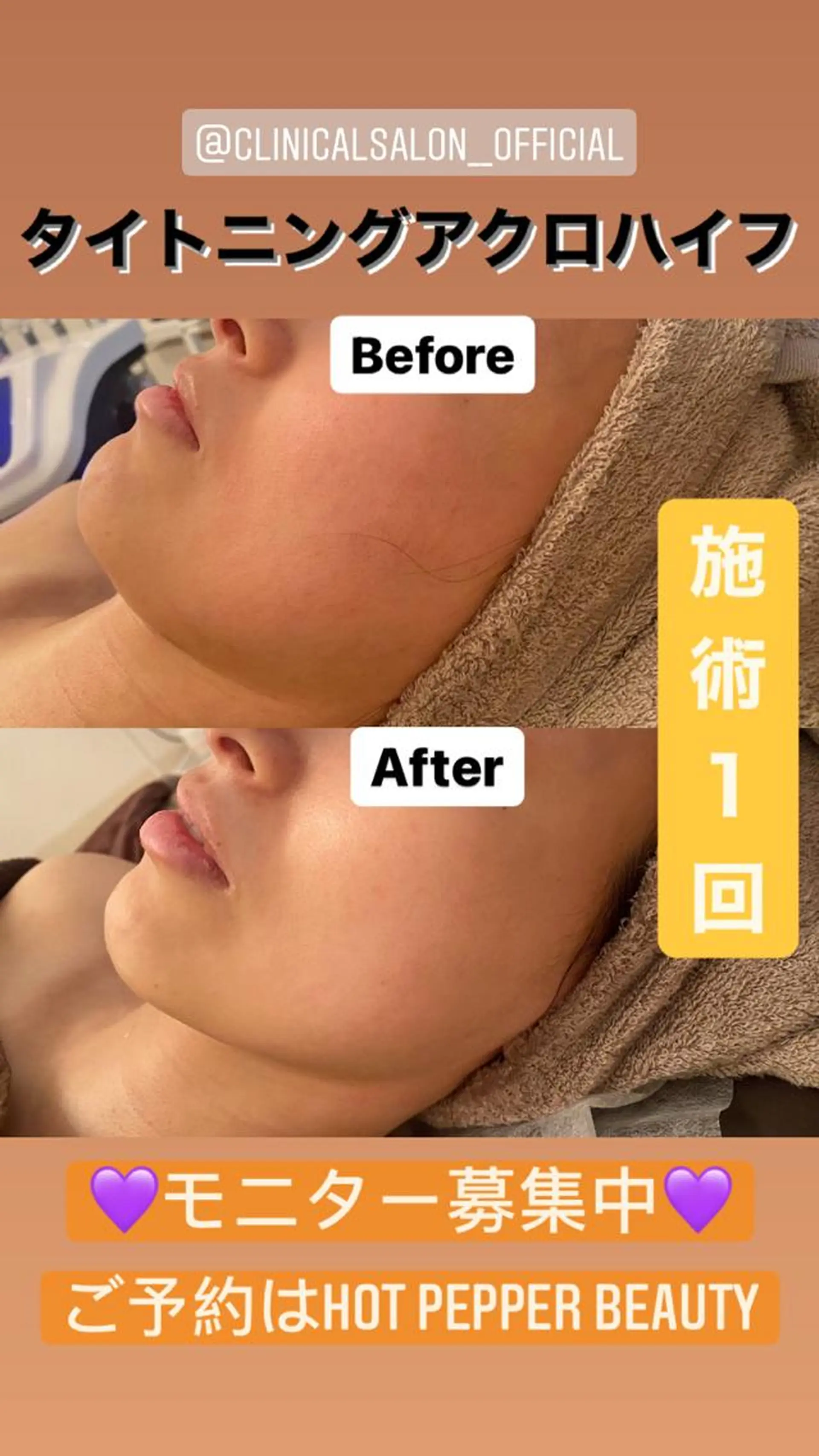 Remina clinical salon所属・ハイフ美肌専門 Remina.c.sのエステ・リラクイメージ