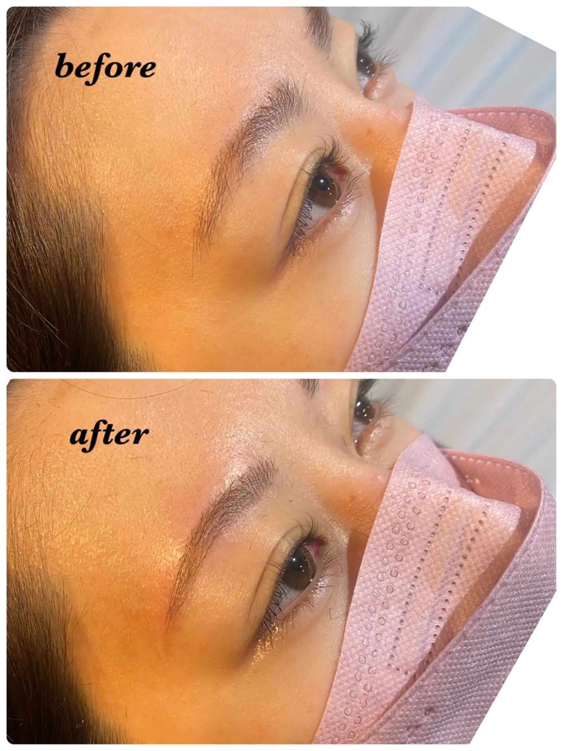 アイブロウ ハーブピーリング/韓国肌管理/フェイシャル/毛穴洗浄/眉毛/顔脱毛【糸脱毛専門】rev所属・ハーブピーリング🌹 毛穴洗浄❤️眉waxのエステ・リラクイメージ