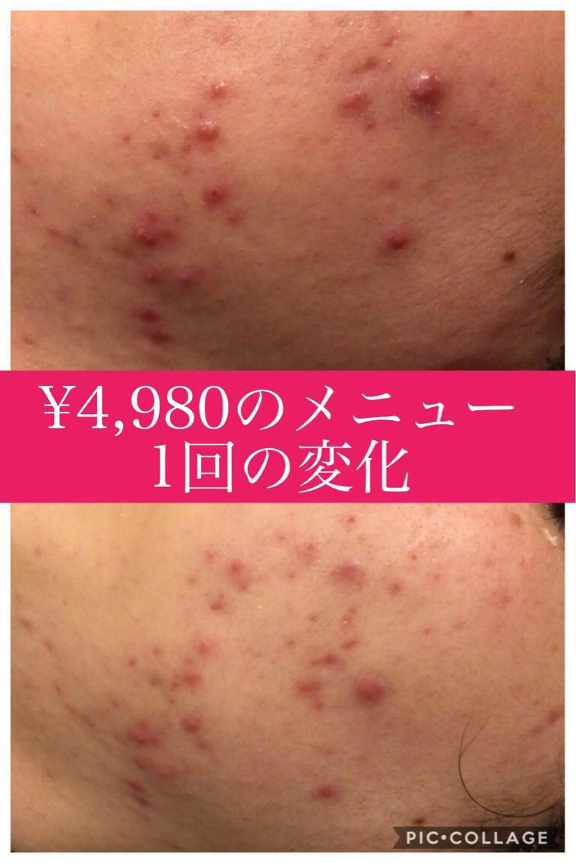 ミディアム カラー パーマ ヘアアレンジ メンズ キッズ ネイル マツエク・マツパ ニキビ・肌質改善専門 ♡人生が変わるサロンのエステ・リラクイメージ