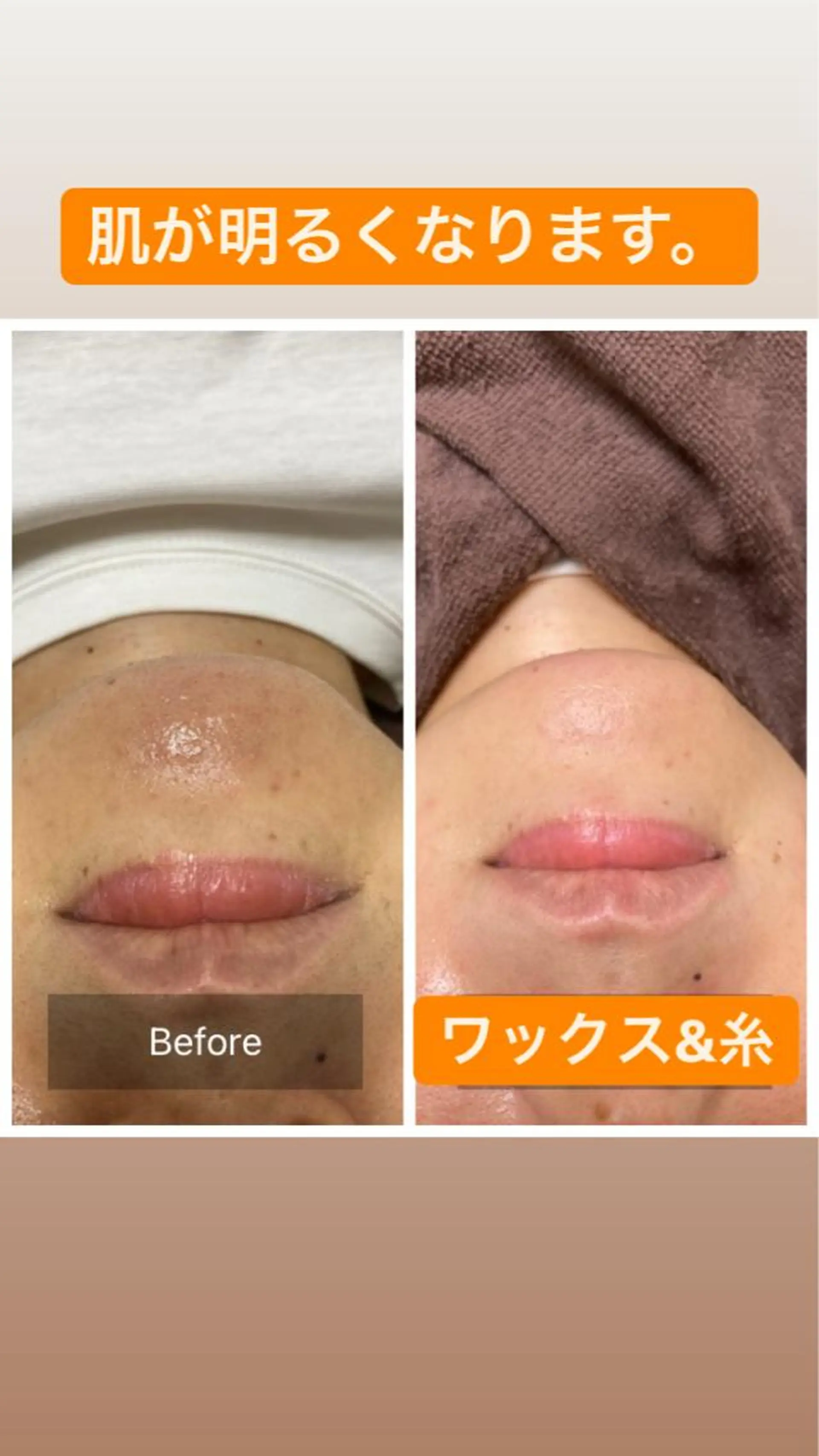 脱毛 産毛専門店 Bittoのエステ・リラクイメージ