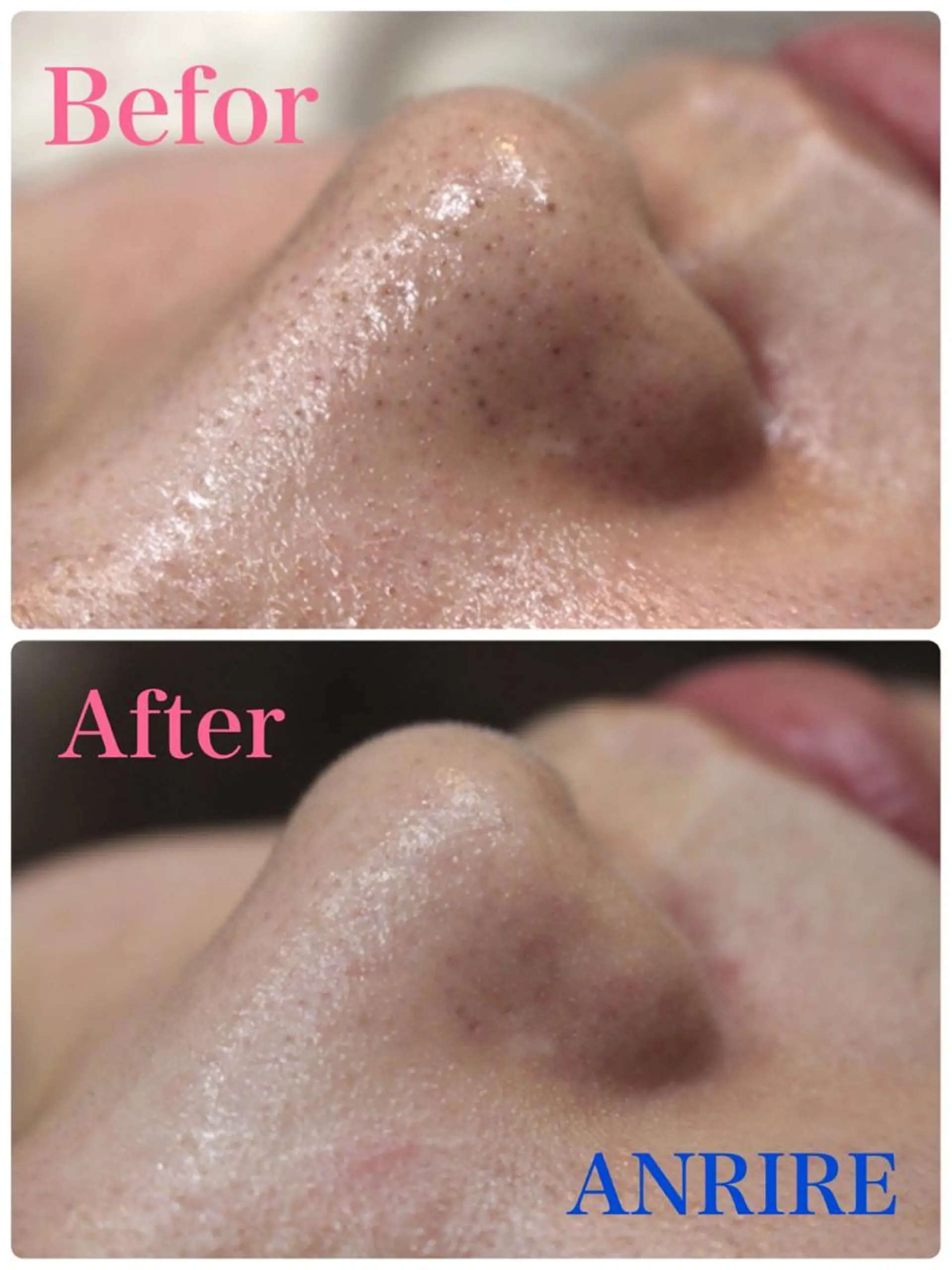 エステ ANRIRE (アンリール)のエステ・リラクイメージ