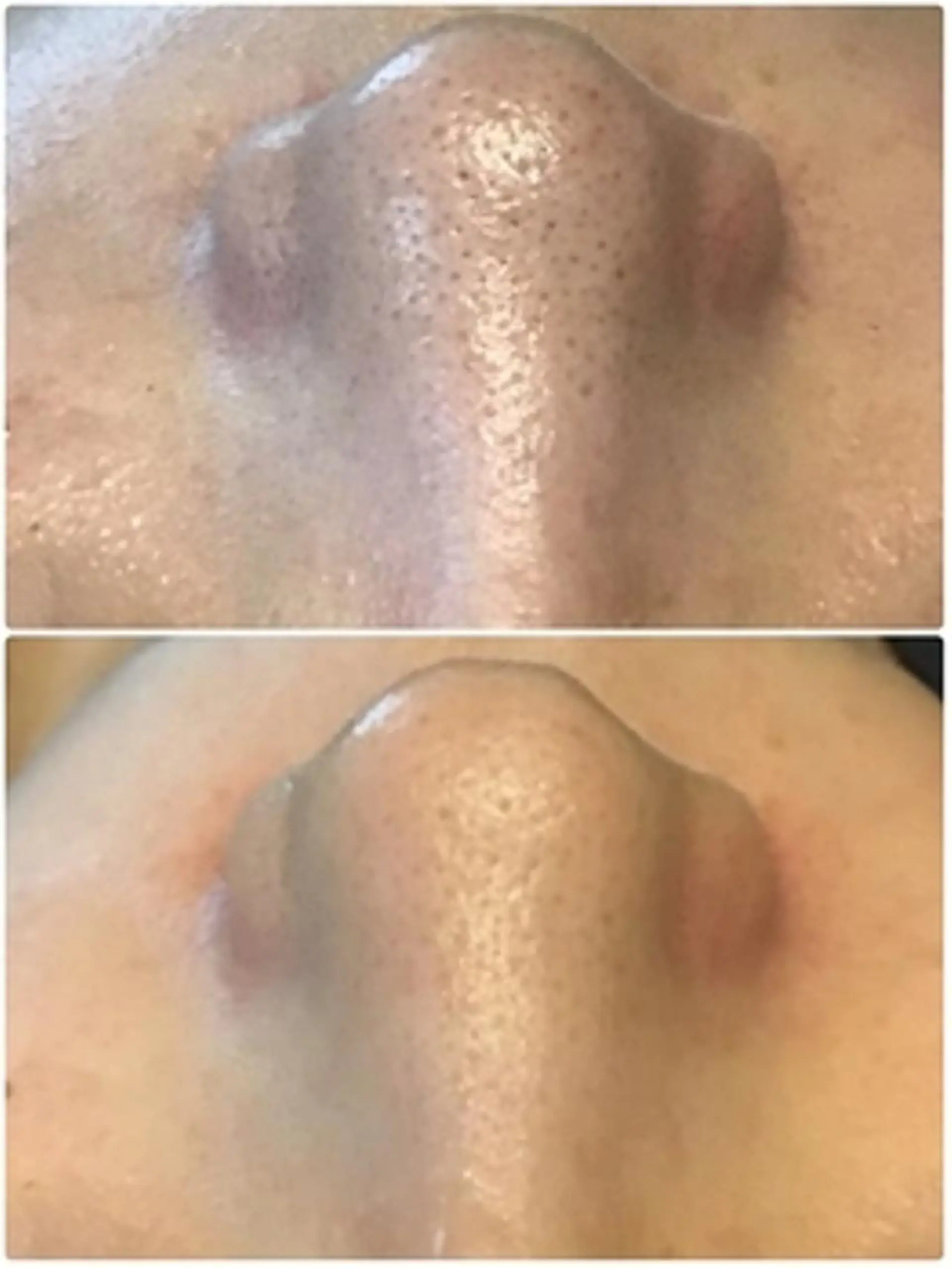 EYE LASH LAPISのエステ・リラクイメージ