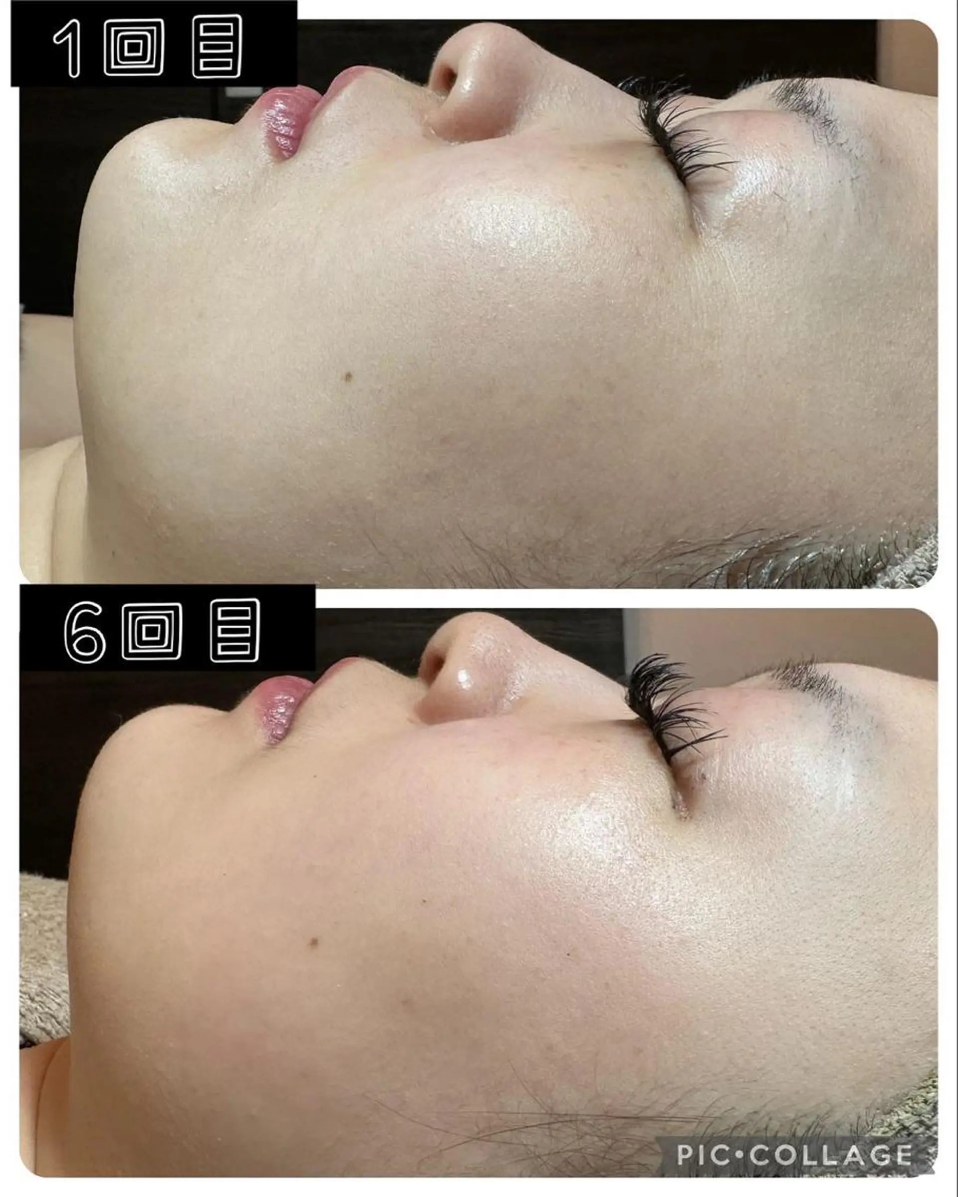 エステ Feel♡ JYURIAのネイルデザイン