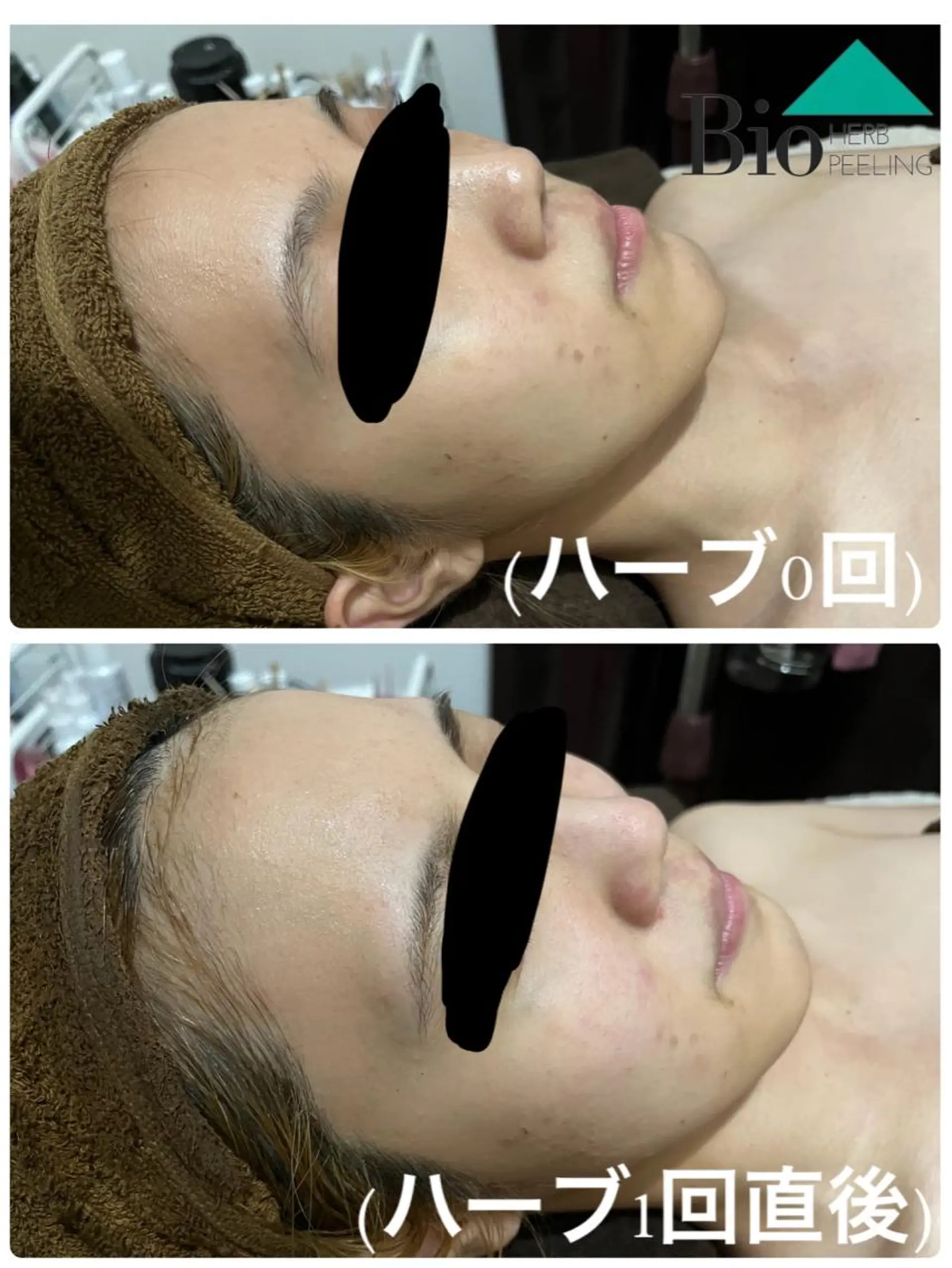 SALON BioBioのエステ・リラクイメージ