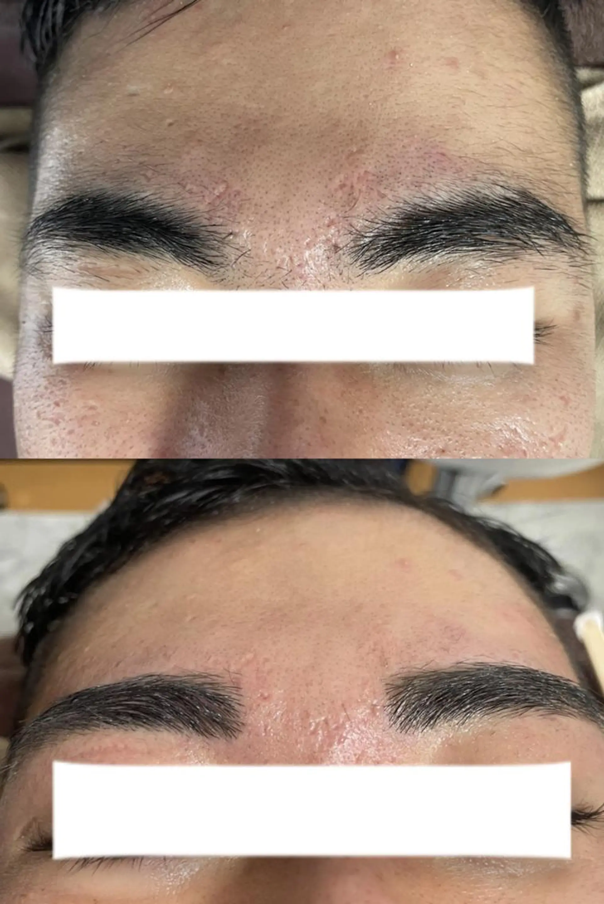 メンズ キッズ アイブロウ ワックス脱毛 Epina 千葉店 【エピナ】のエステ・リラクイメージ