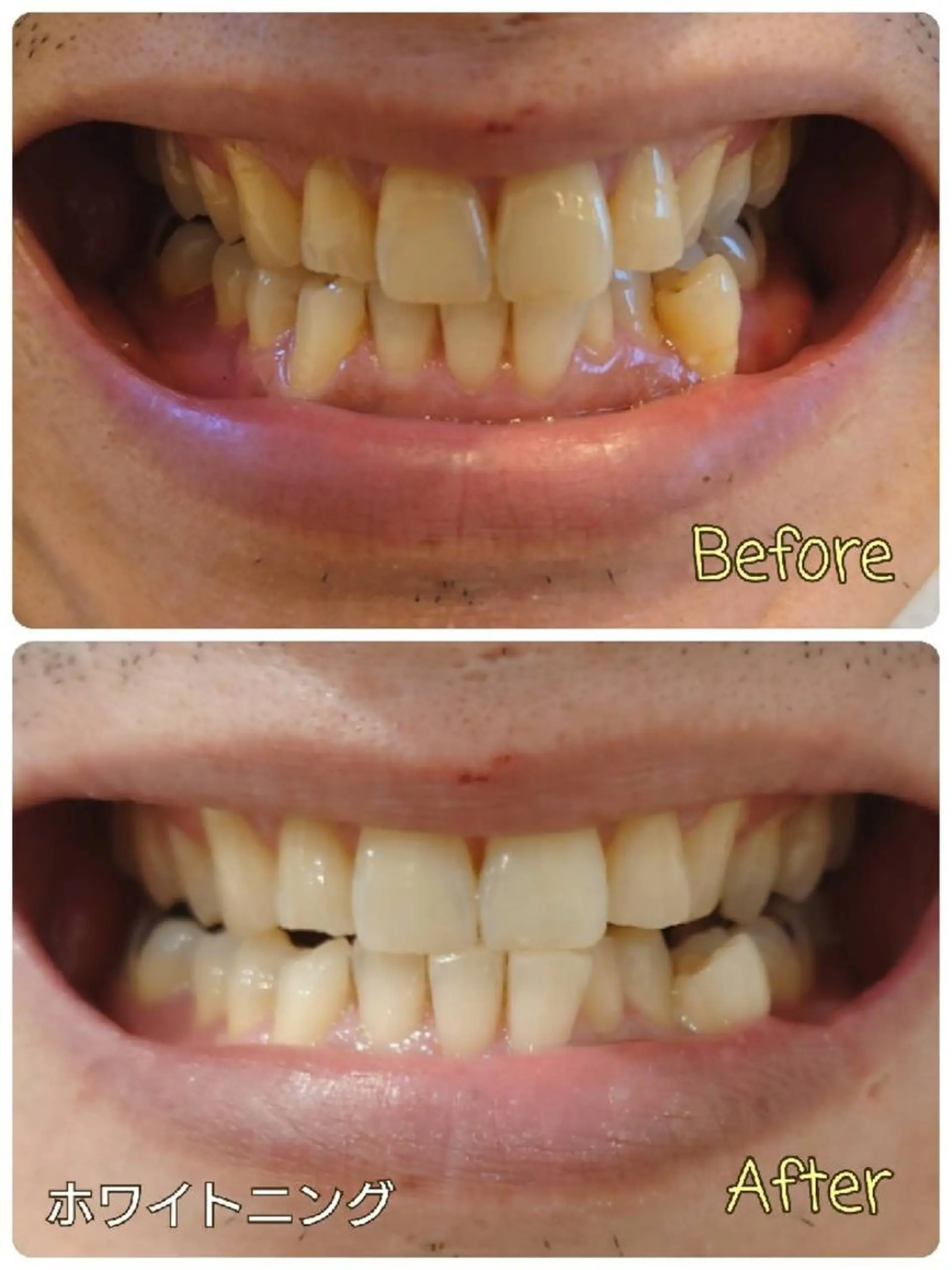 M✨ Hoshi💎✨のエステ・リラクイメージ