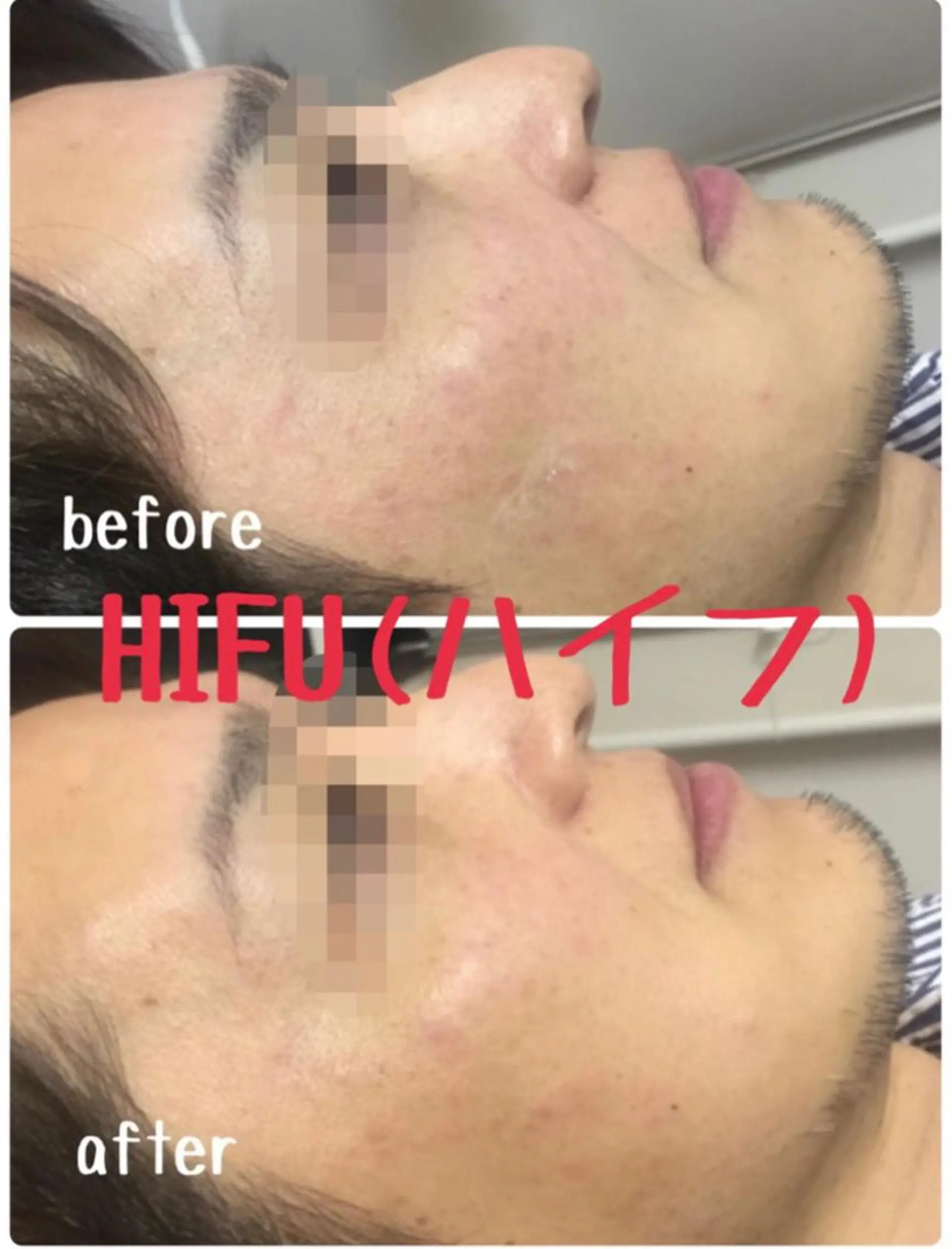 肌質改善サロンChouChou所属・肌質改善サロン chouchouのエステ・リラクイメージ