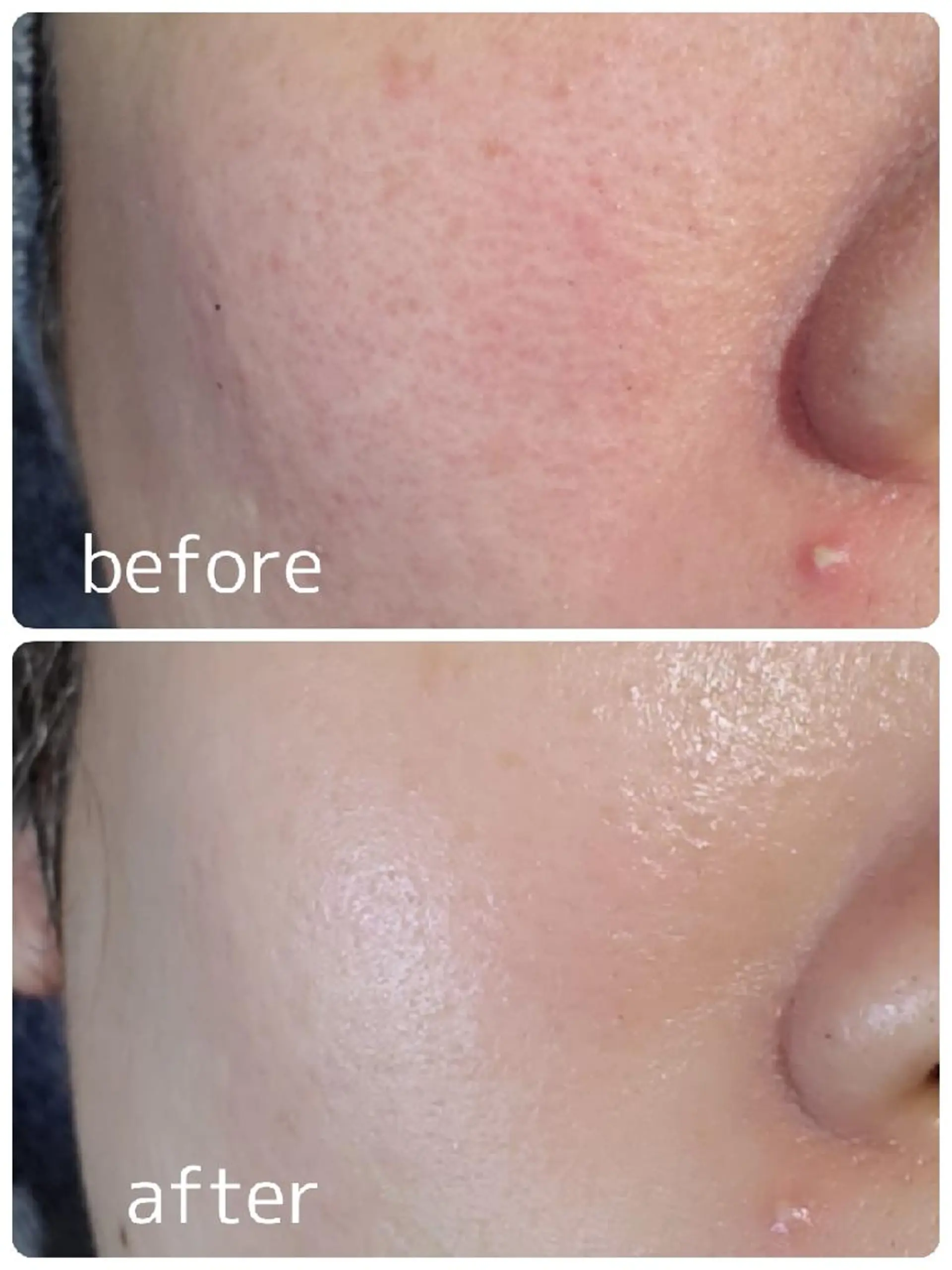 REGARD所属・Taniguchi Mのエステ・リラクイメージ