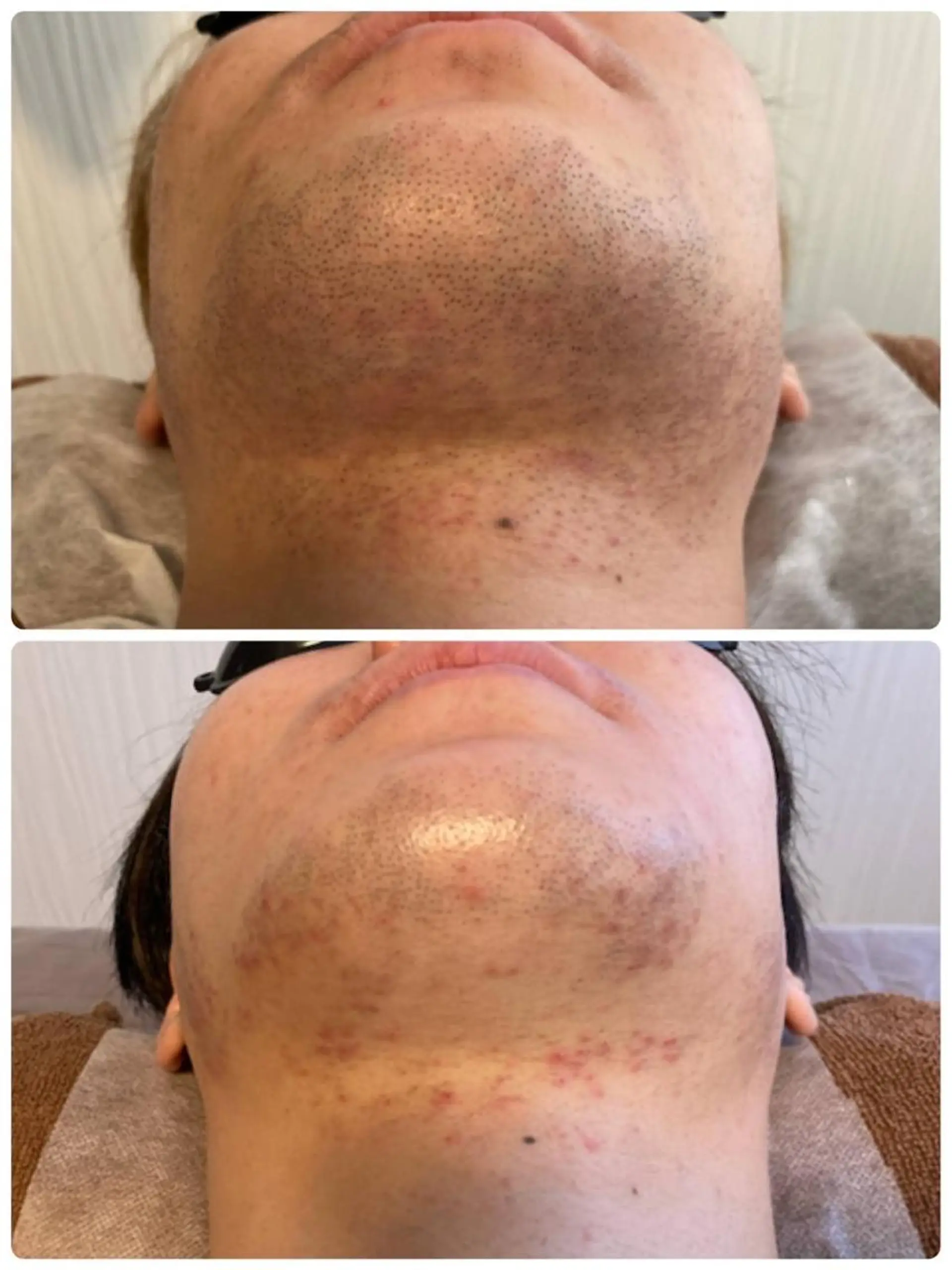 メンズ レグルスゼロ 甲府店のエステ・リラクイメージ