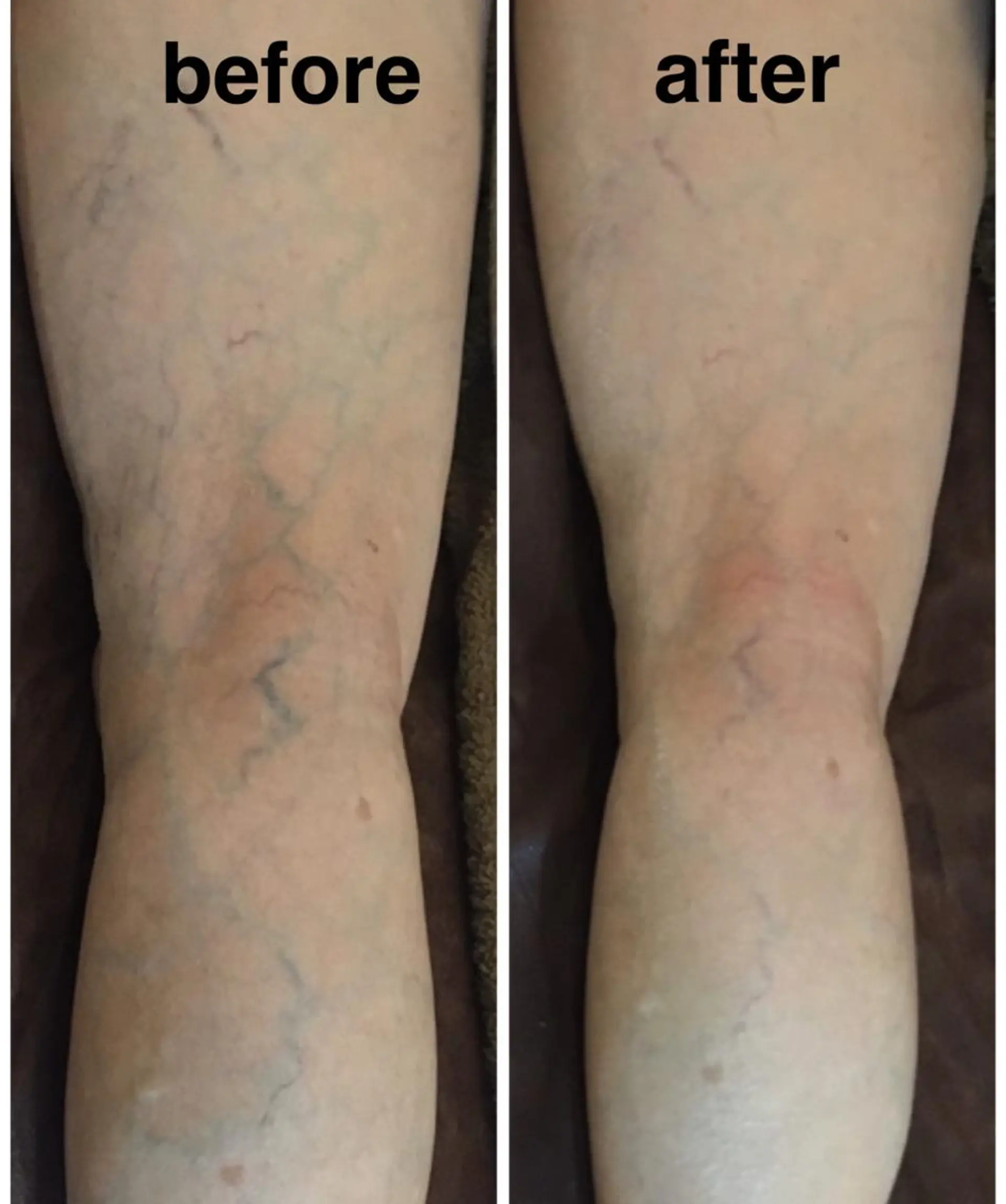 エステ リラク Beauty GYM 極美〜kiwami〜所属・藤原 雪美のエステ・リラクイメージ