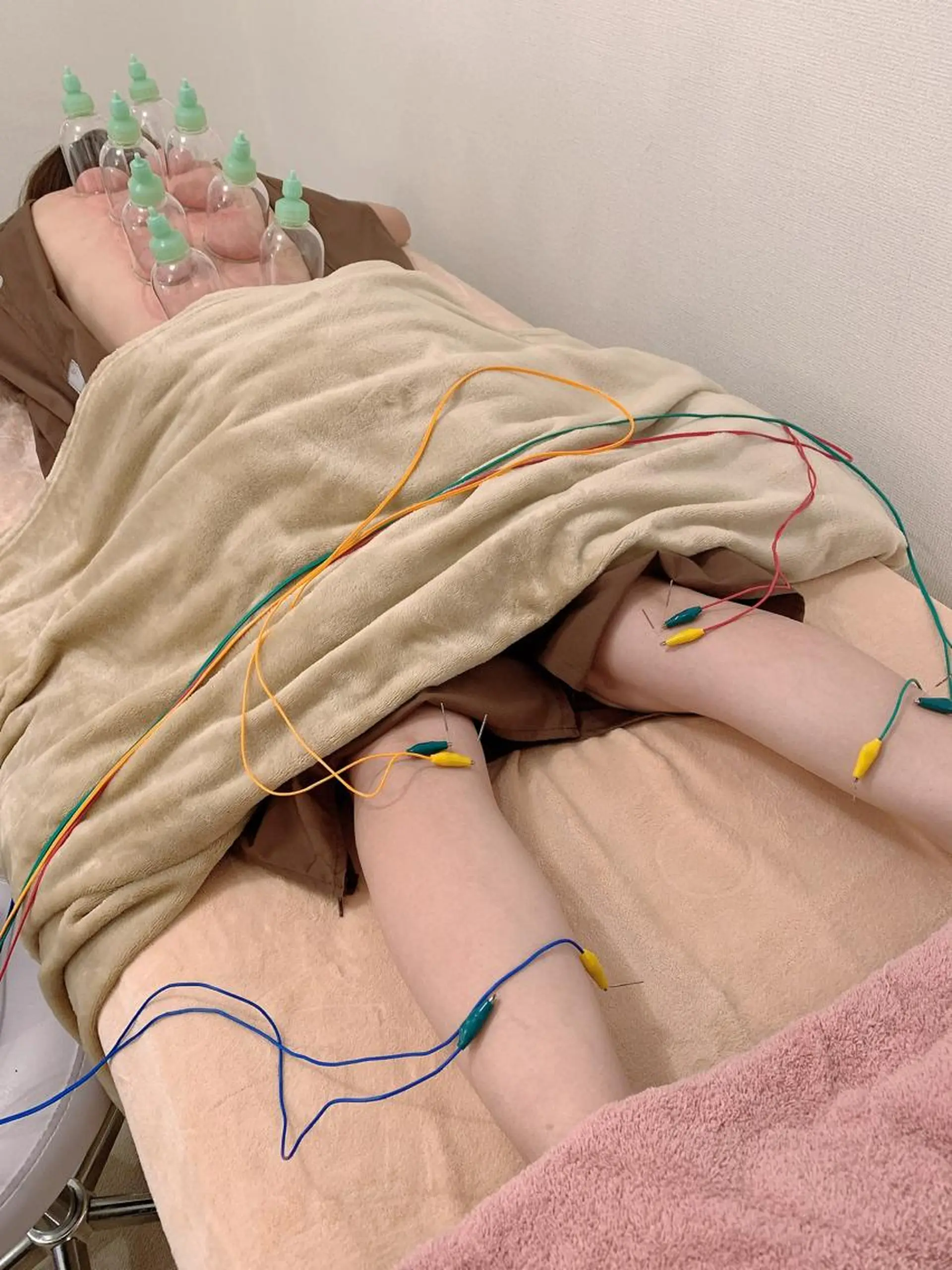 新宿hari-me所属・美容鍼hari-me 新宿のエステ・リラクイメージ