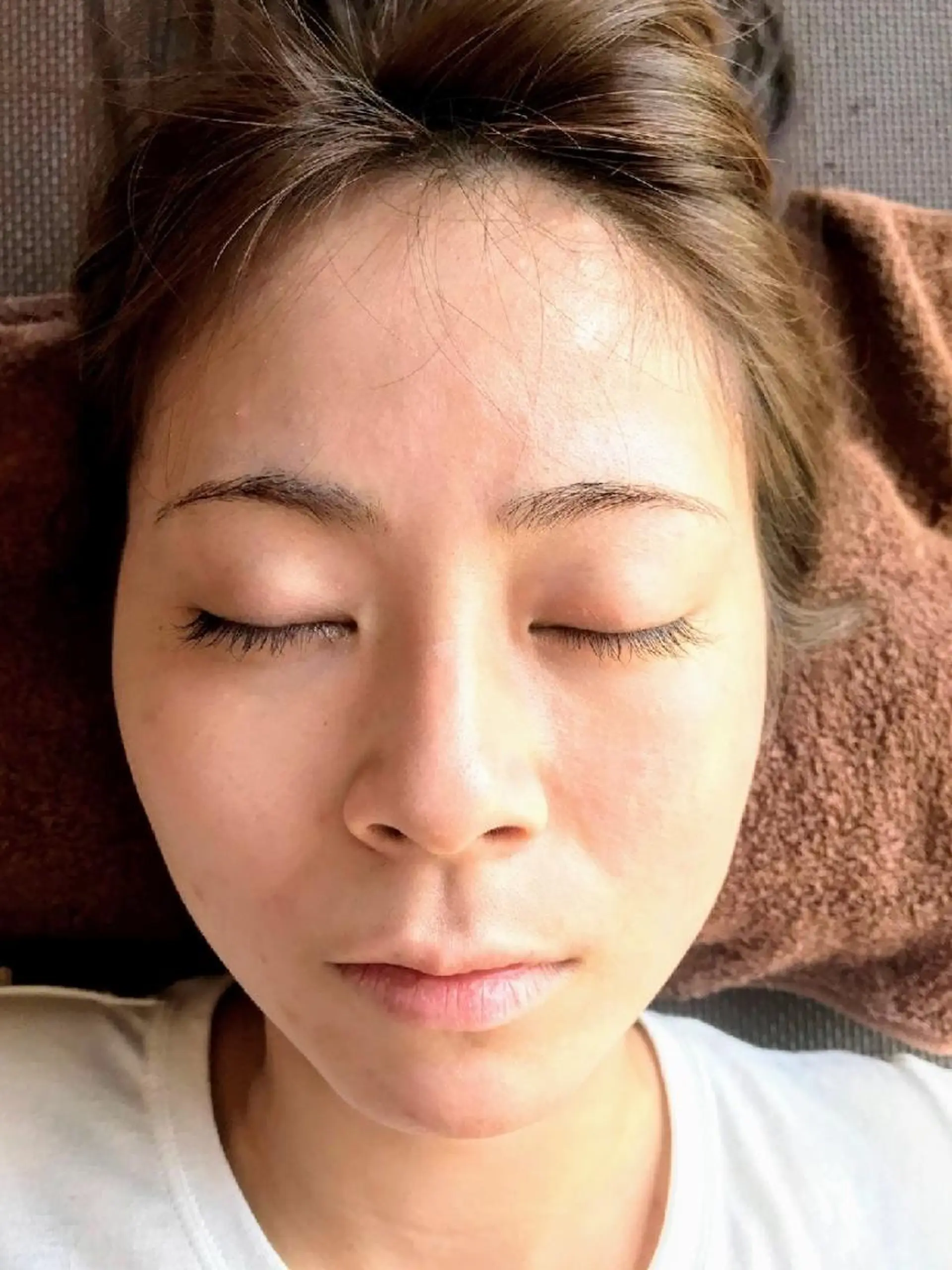 じゅうそう 鍼灸整骨院のエステ・リラクイメージ