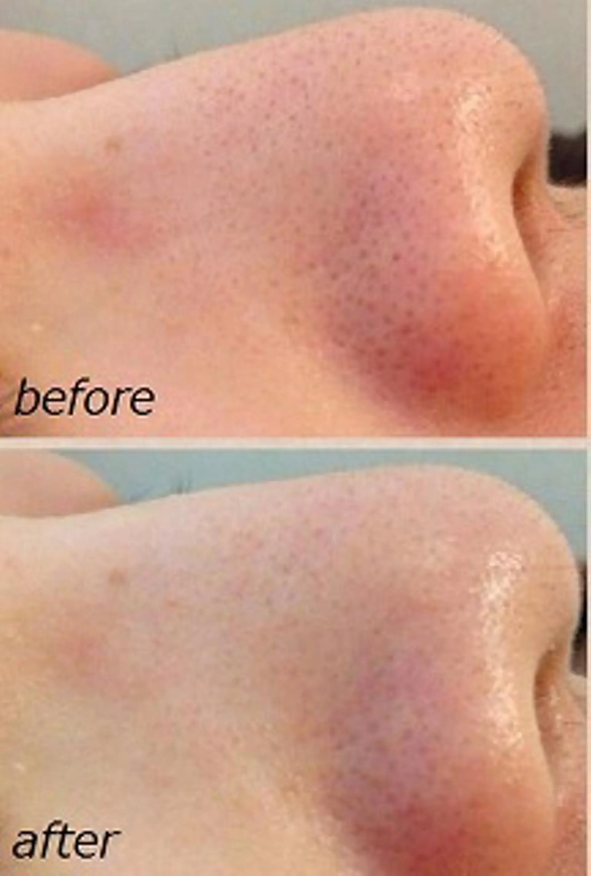 ANRIRE (アンリール)のエステ・リラクイメージ