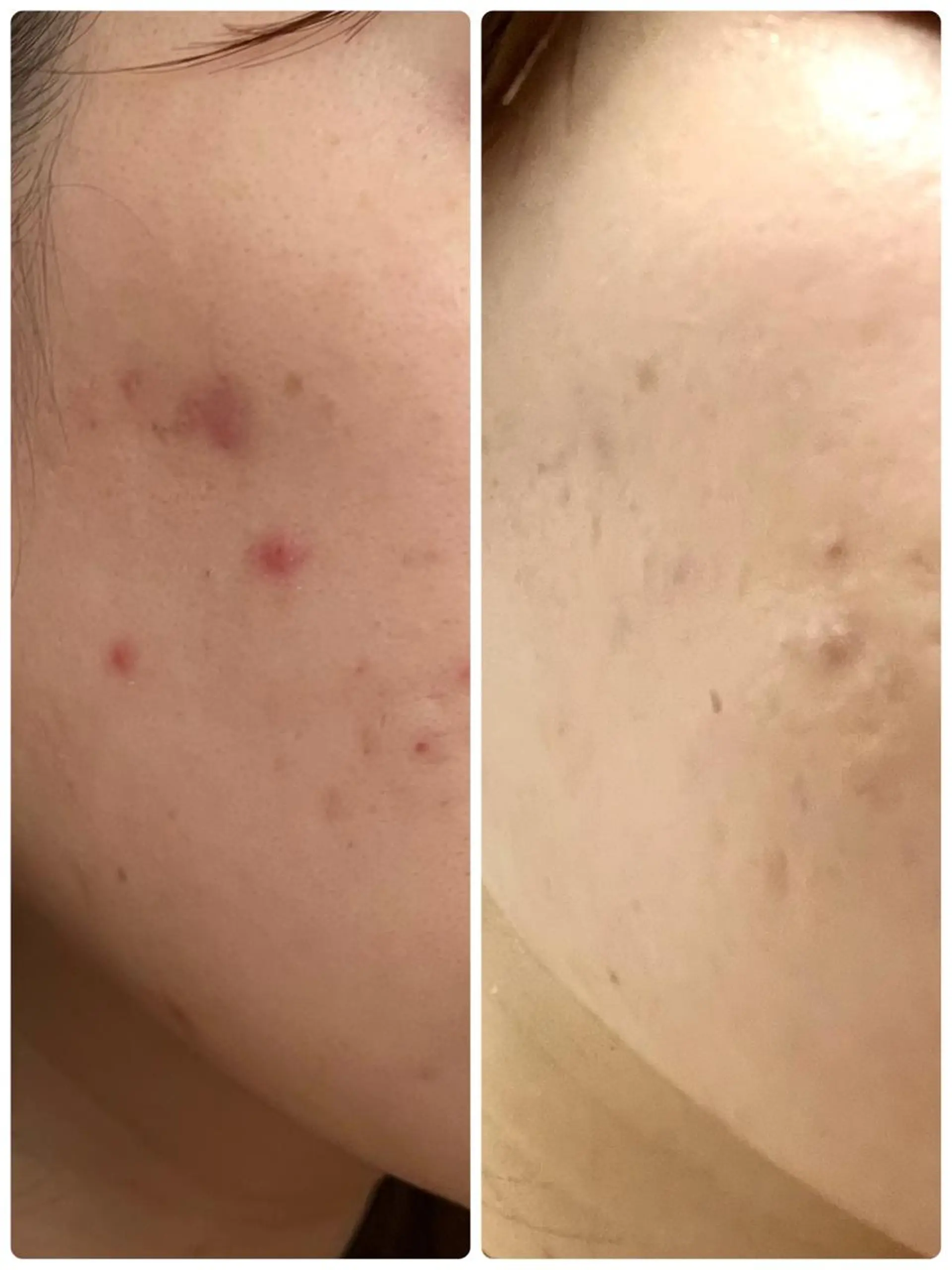 mignon /栄のエステ・リラクイメージ