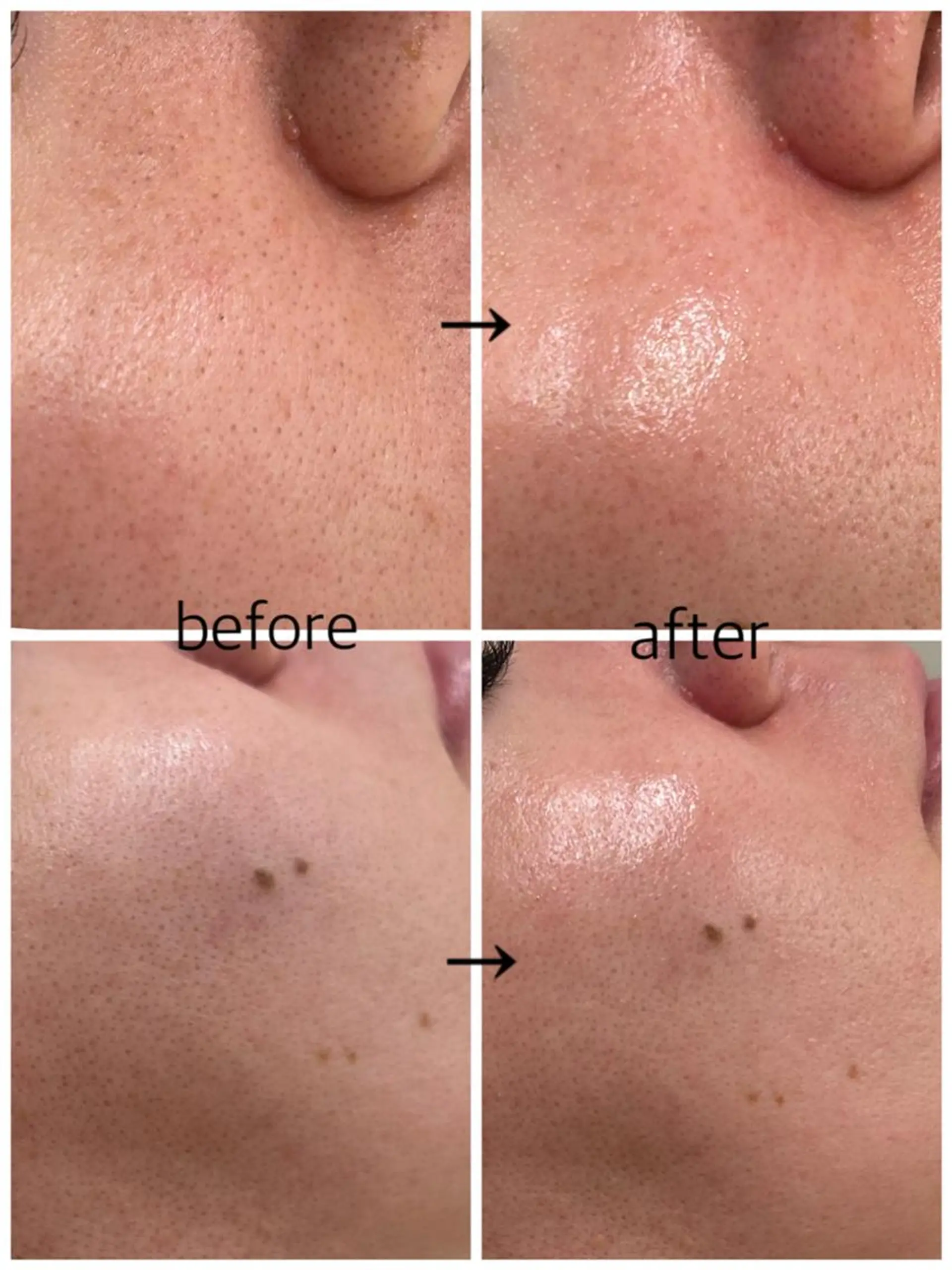 レッスンモデル募集♡ ツヤ肌Wax/VIOのエステ・リラクイメージ