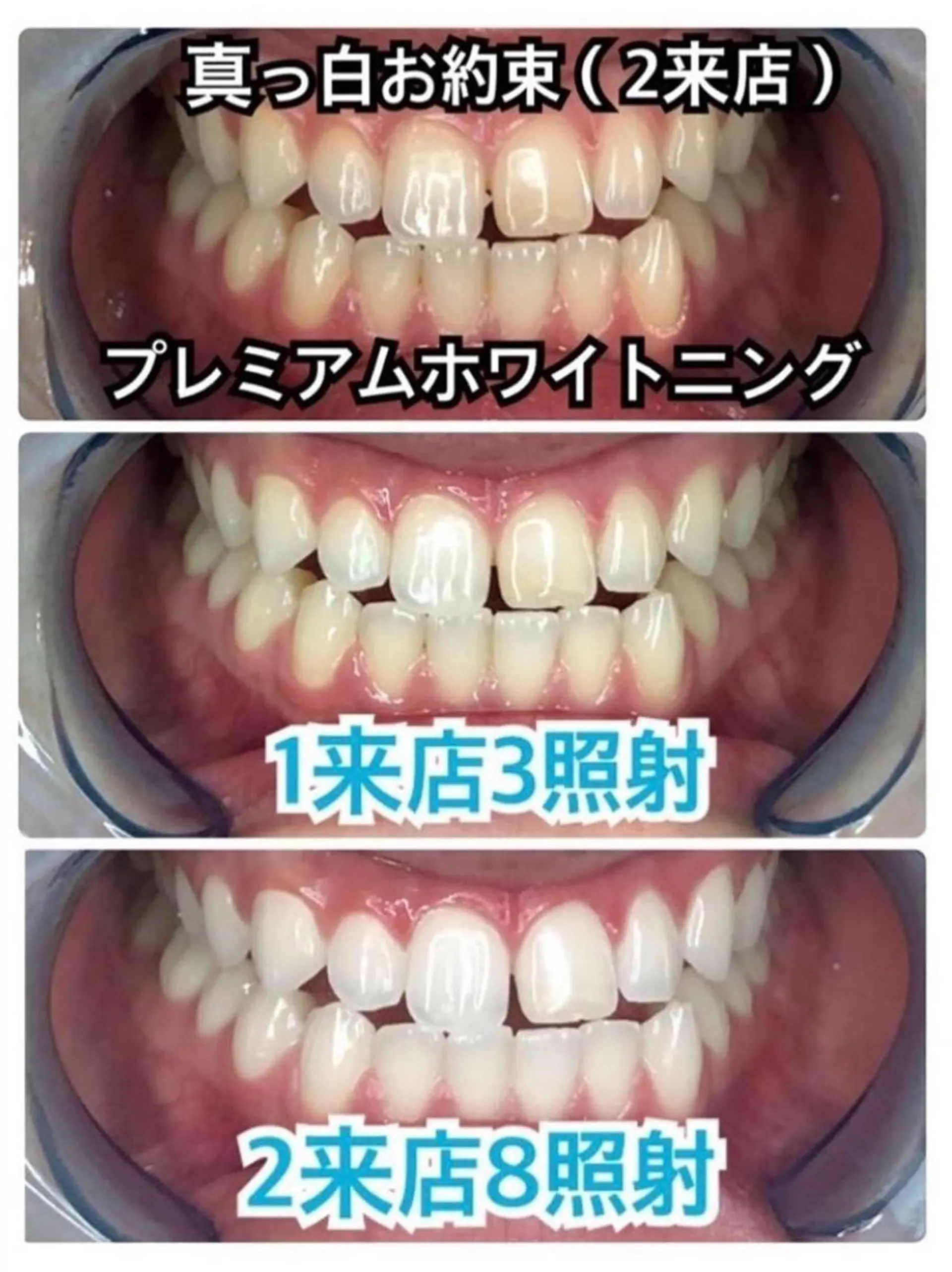 その他 ライトビューティー 恵比寿店のその他イメージ