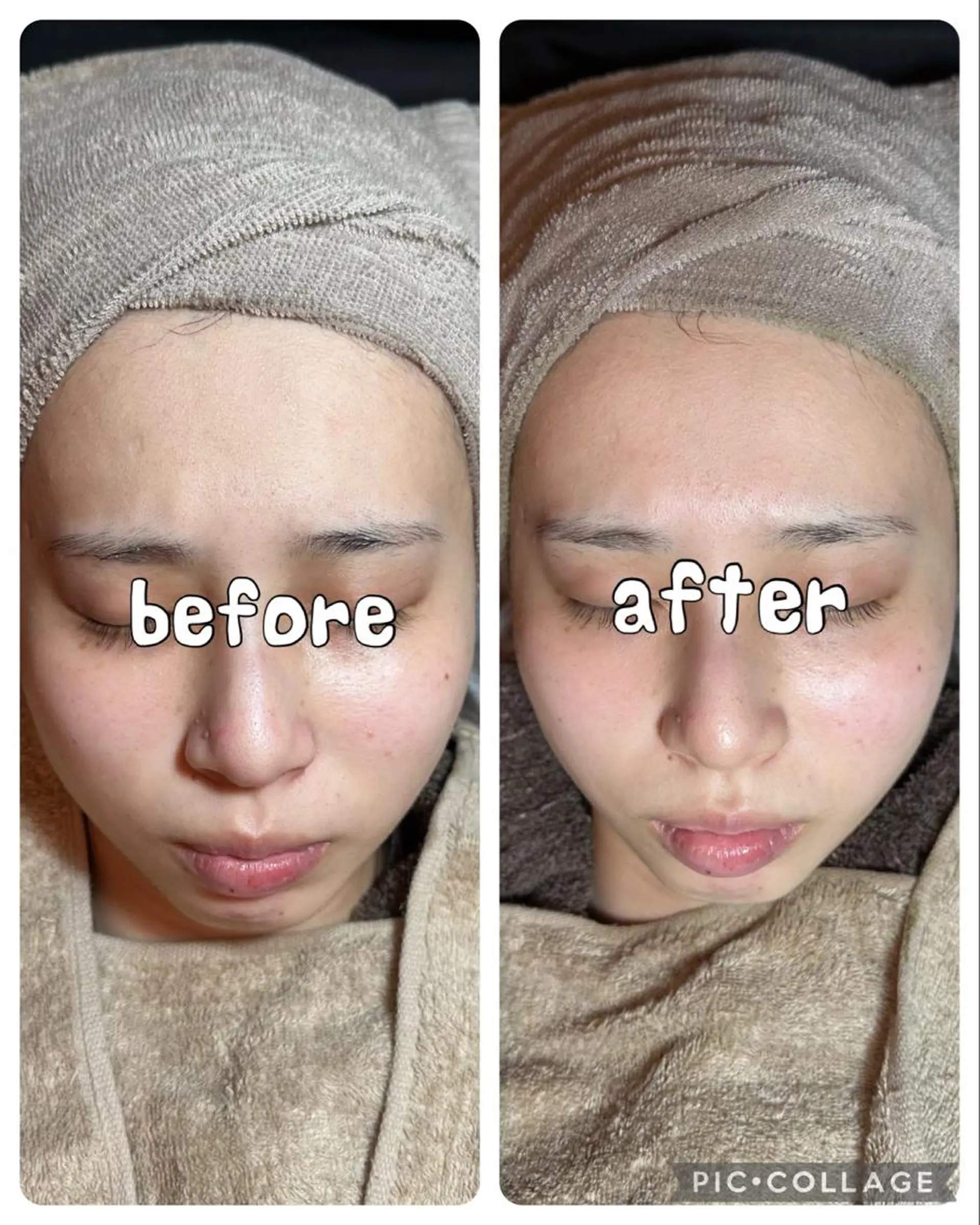 エステ Feel♡ JYURIAのネイルデザイン