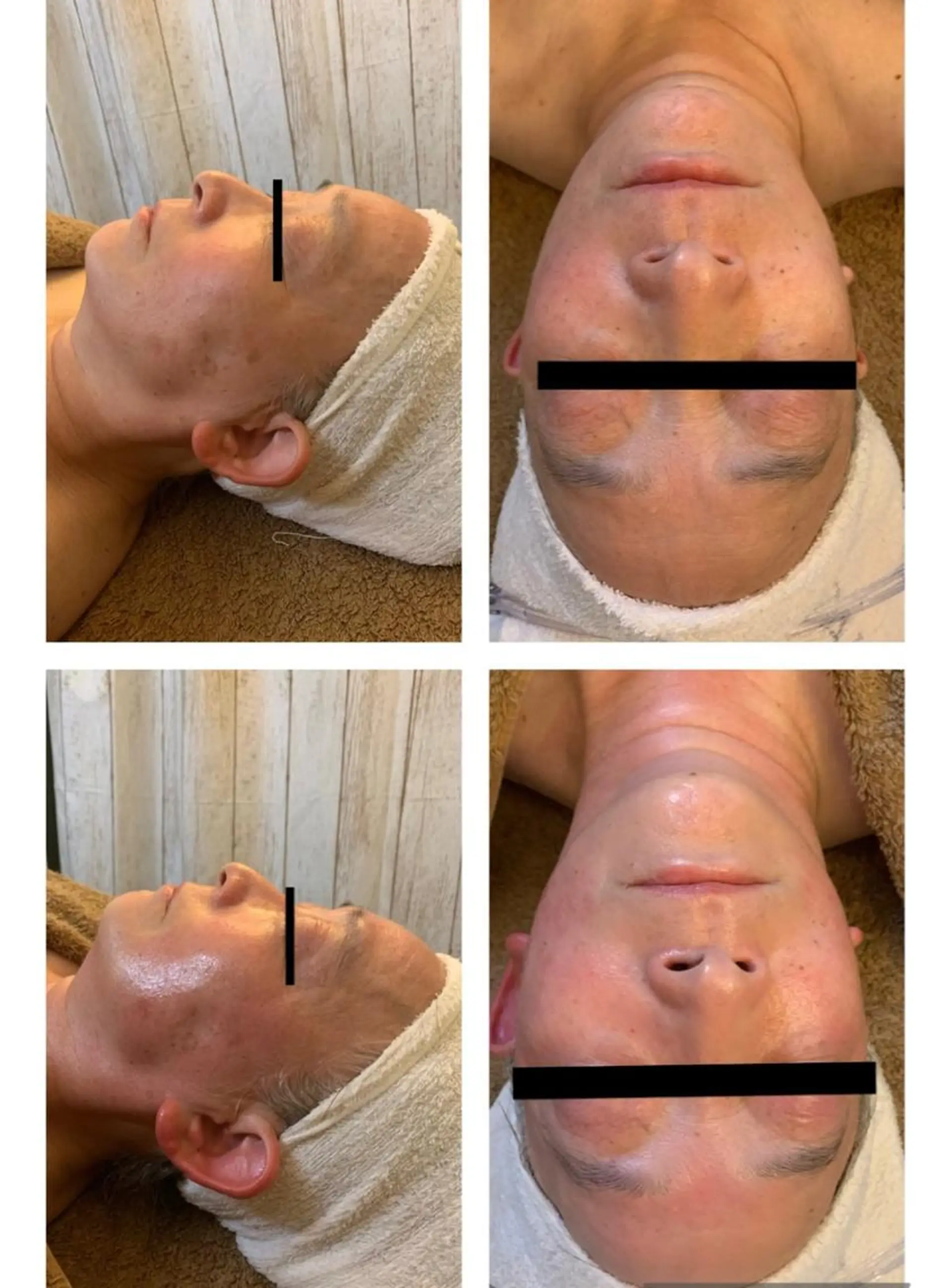 エステ リラク ハウオリベリー所属・うえば すみかのエステ・リラクイメージ