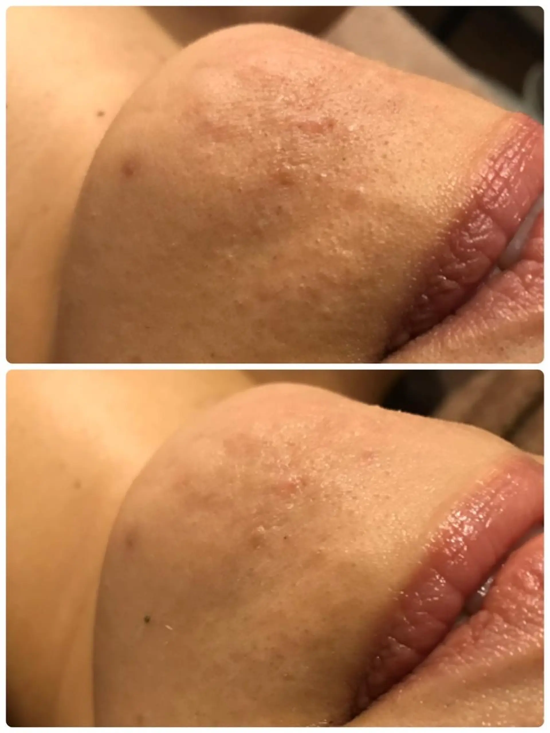 エステ aimee　肌質改善サロン【アイミー】所属・肌質改善サロン aimee｜アイミーのエステ・リラクイメージ