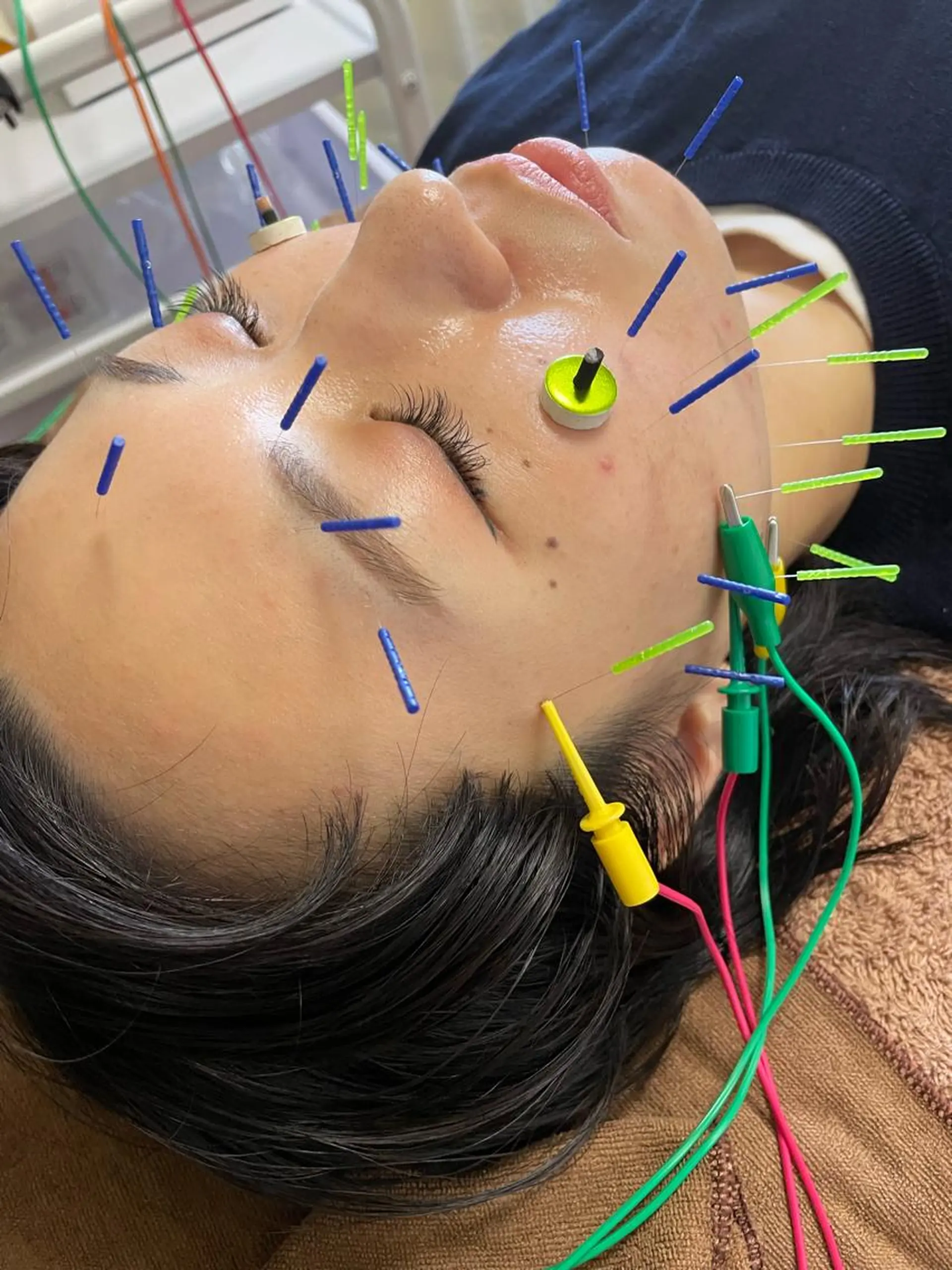 美容鍼灸サロン mahoroba院長のエステ・リラクイメージ