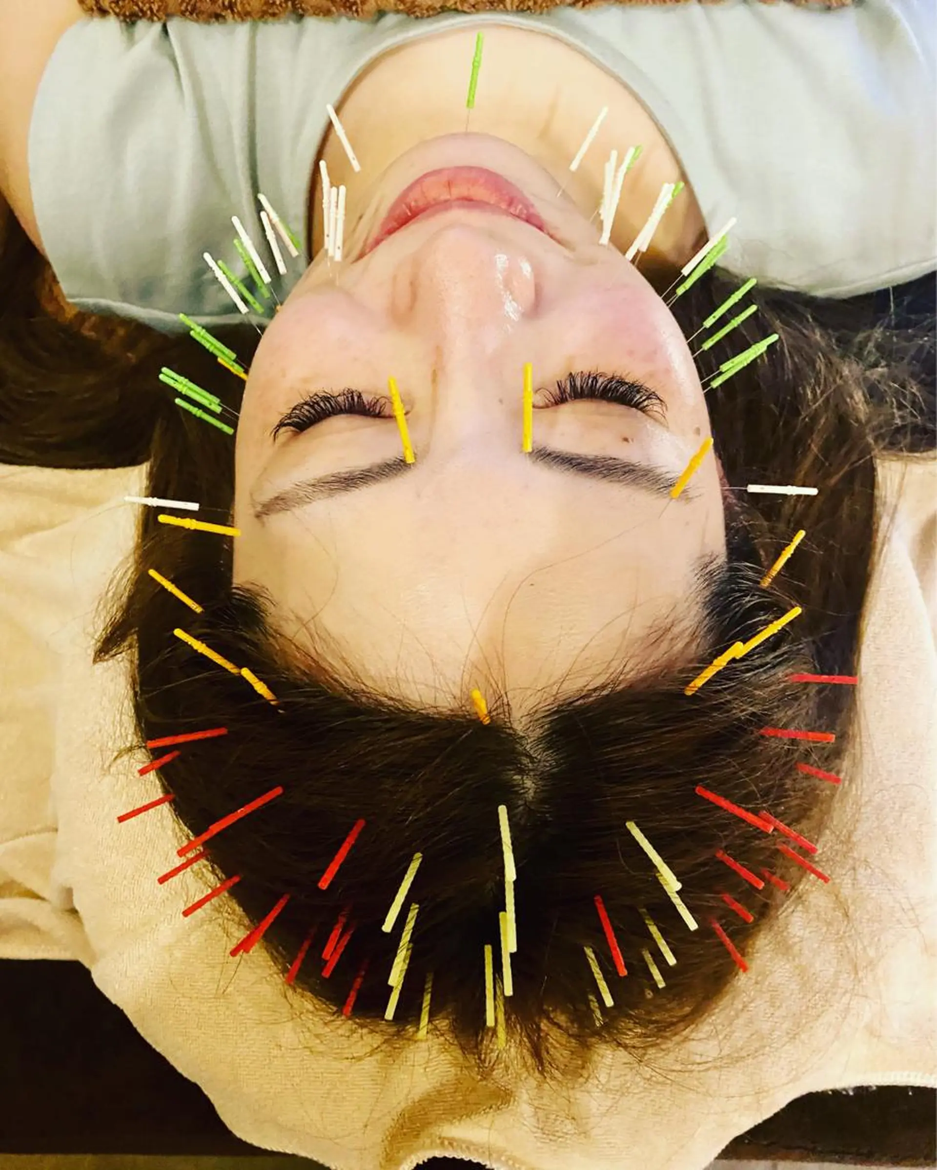 ヘッドスパ Acupuncture  salon LINOA リノア鍼灸院所属・ヘッドスパ鍼/小顔鍼 耳ツボ 　LINOAのエステ・リラクイメージ