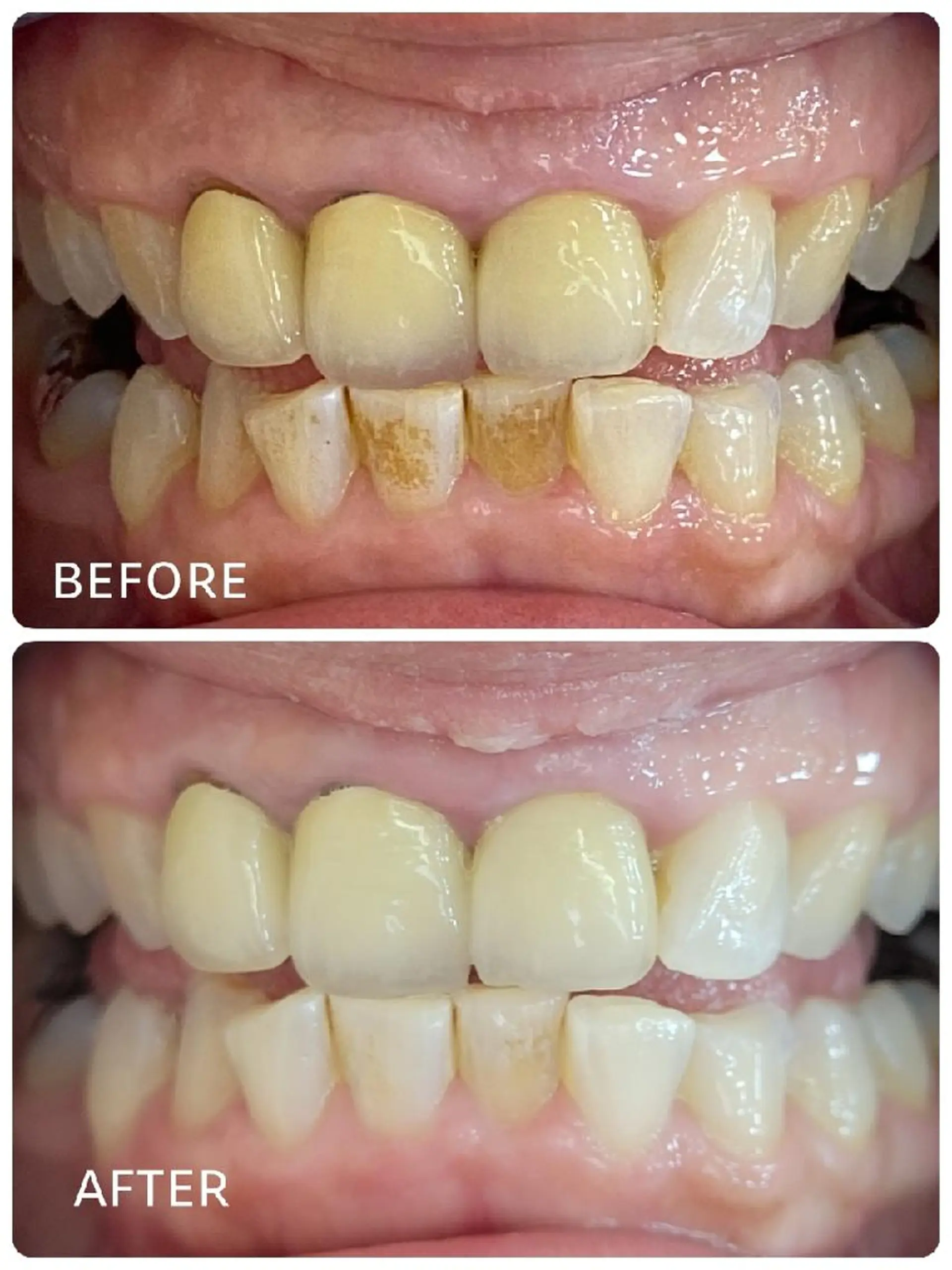 ホワイトニングサロン ラウレアのその他イメージ