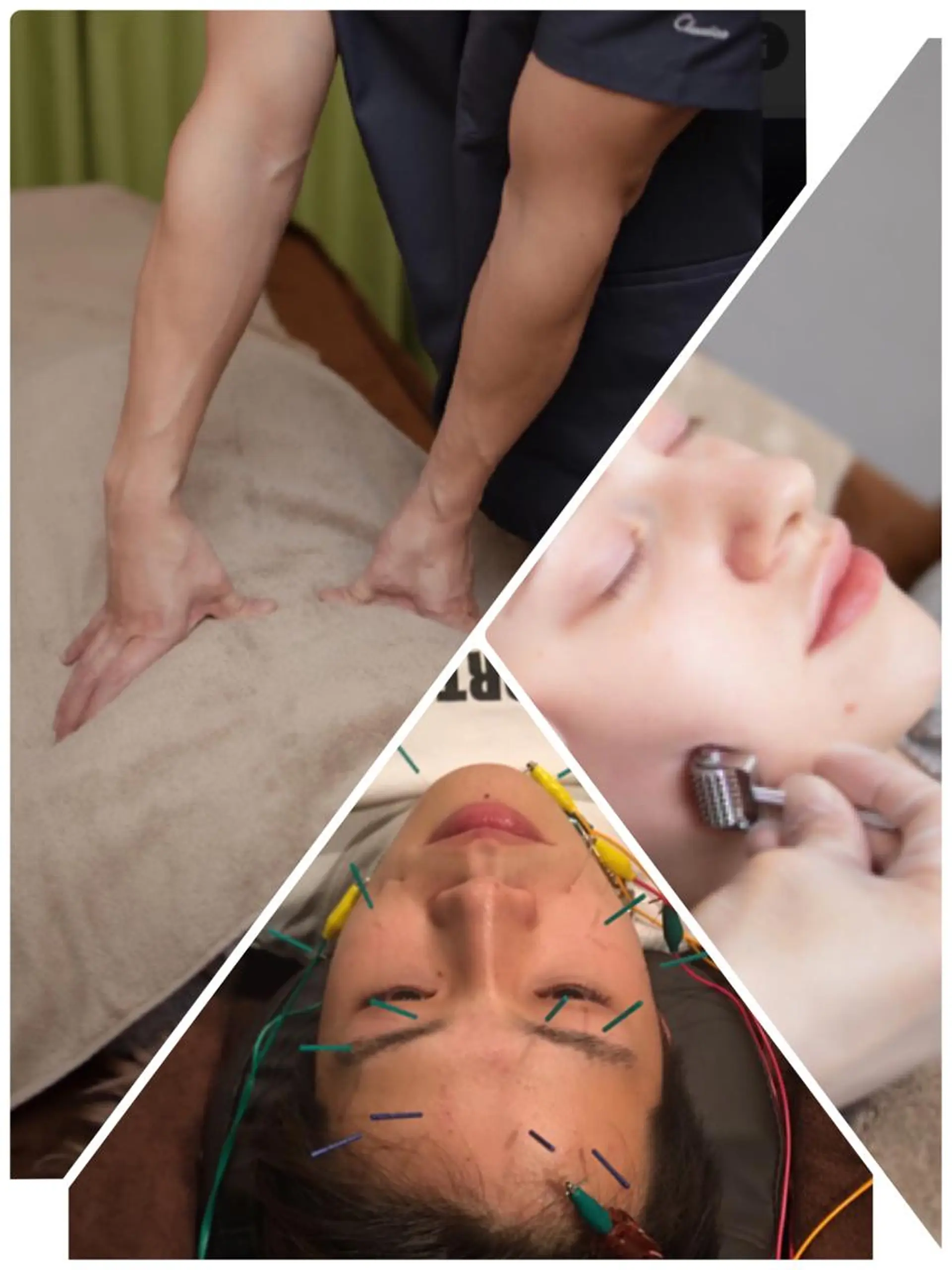 表参道鍼灸院K 美容鍼🔮ララピールのエステ・リラクイメージ