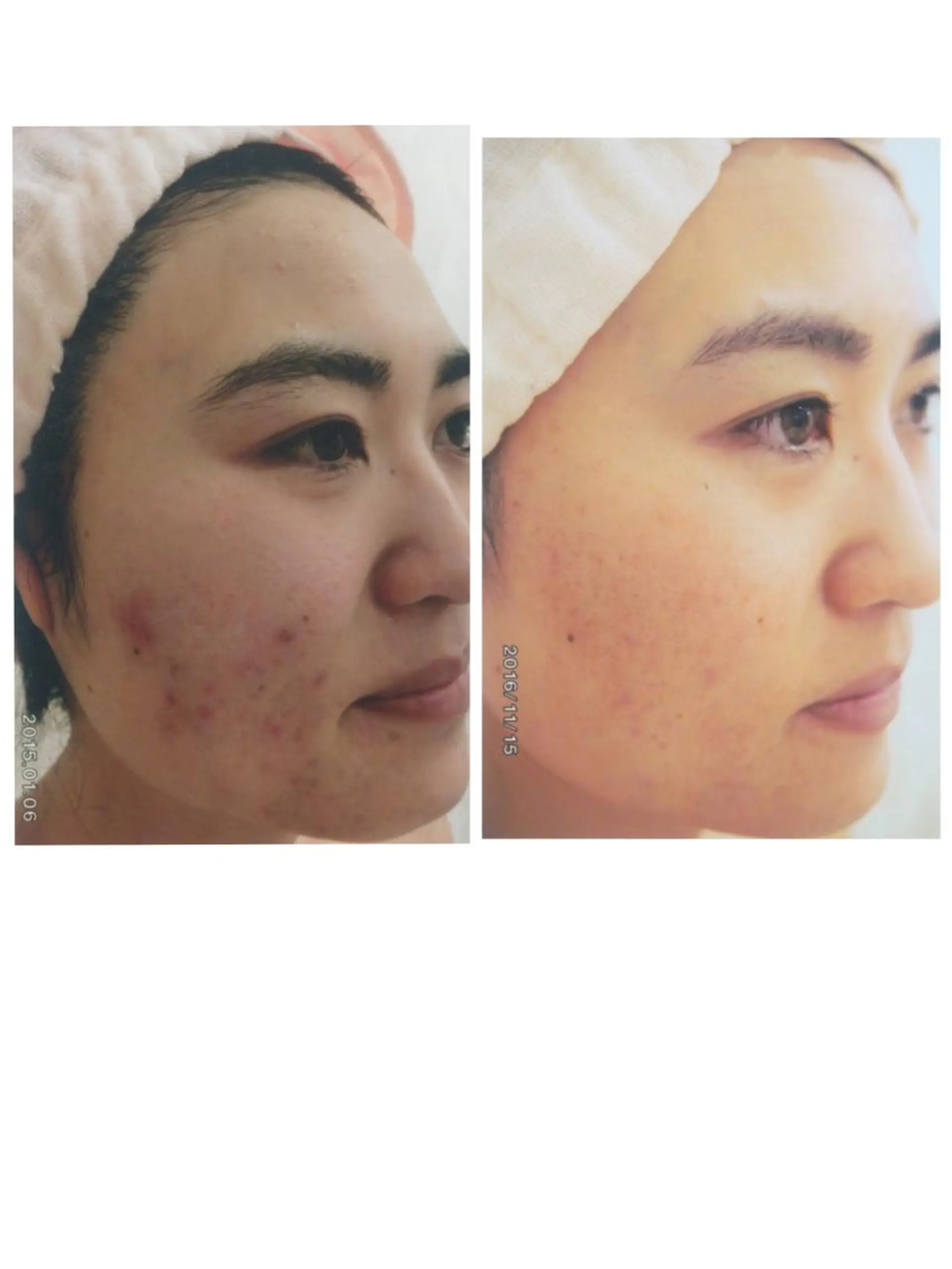 マドンナ 富士店のエステ・リラクイメージ