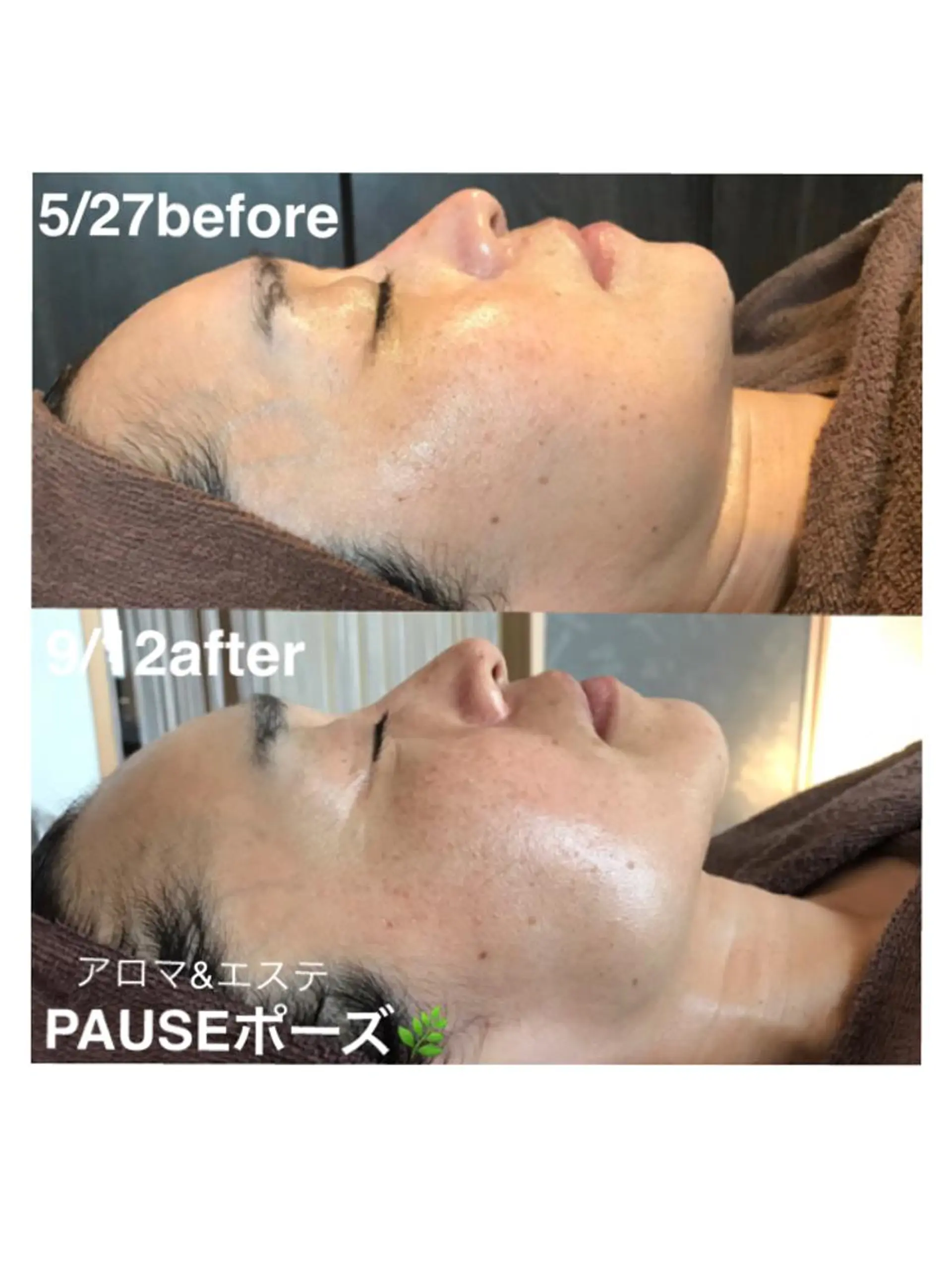 エステ 浜野 恵美のエステ・リラクイメージ