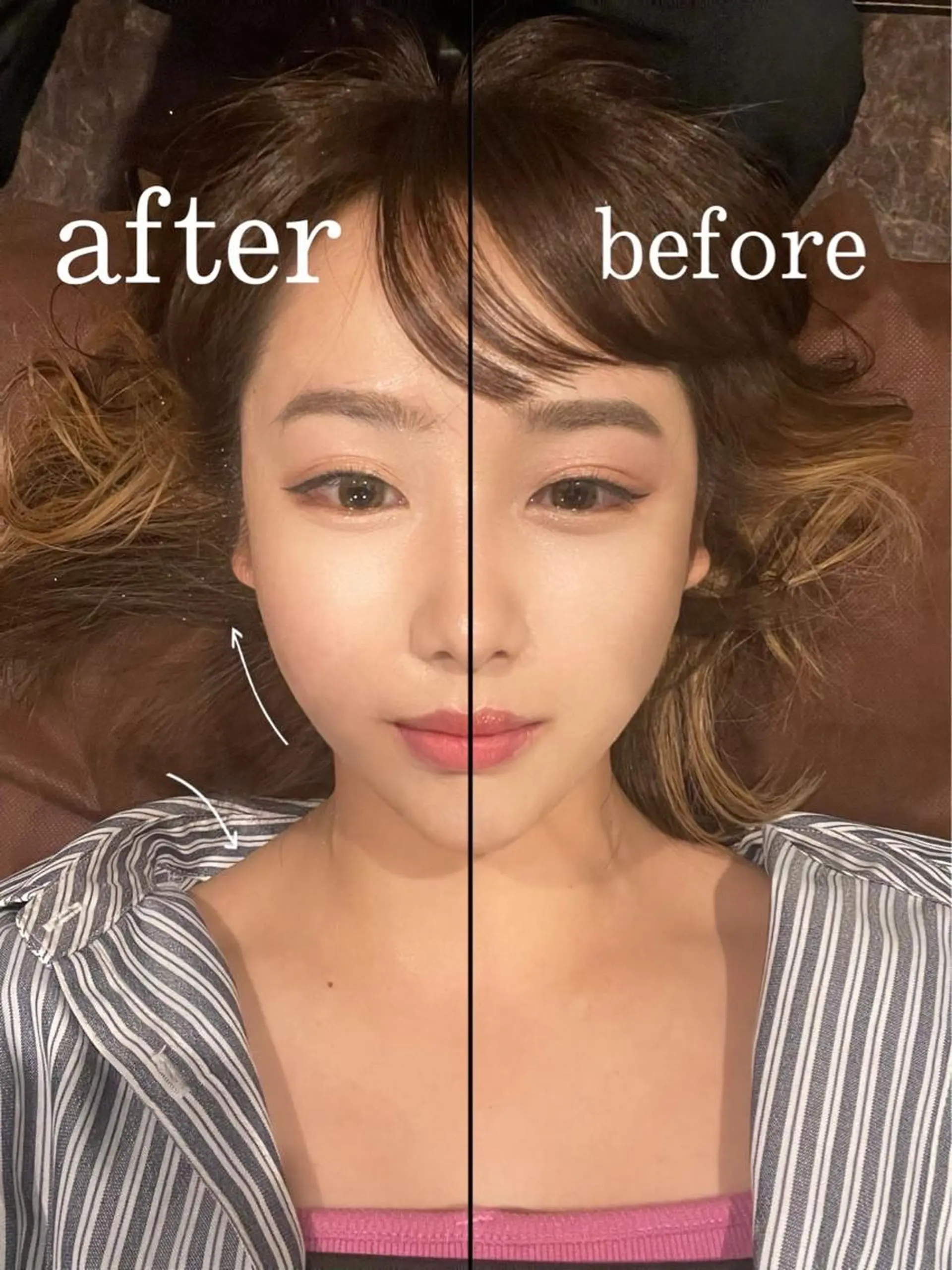 メンズ エステ リラク 美容鍼灸サロン LOMIHARIのエステ・リラクイメージ