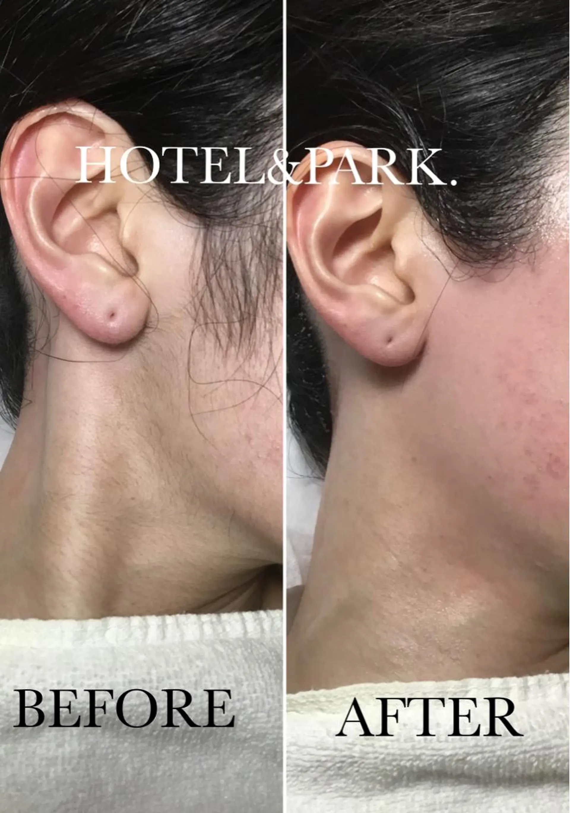 HOTEL&PARK . ワックス脱毛のエステ・リラクイメージ