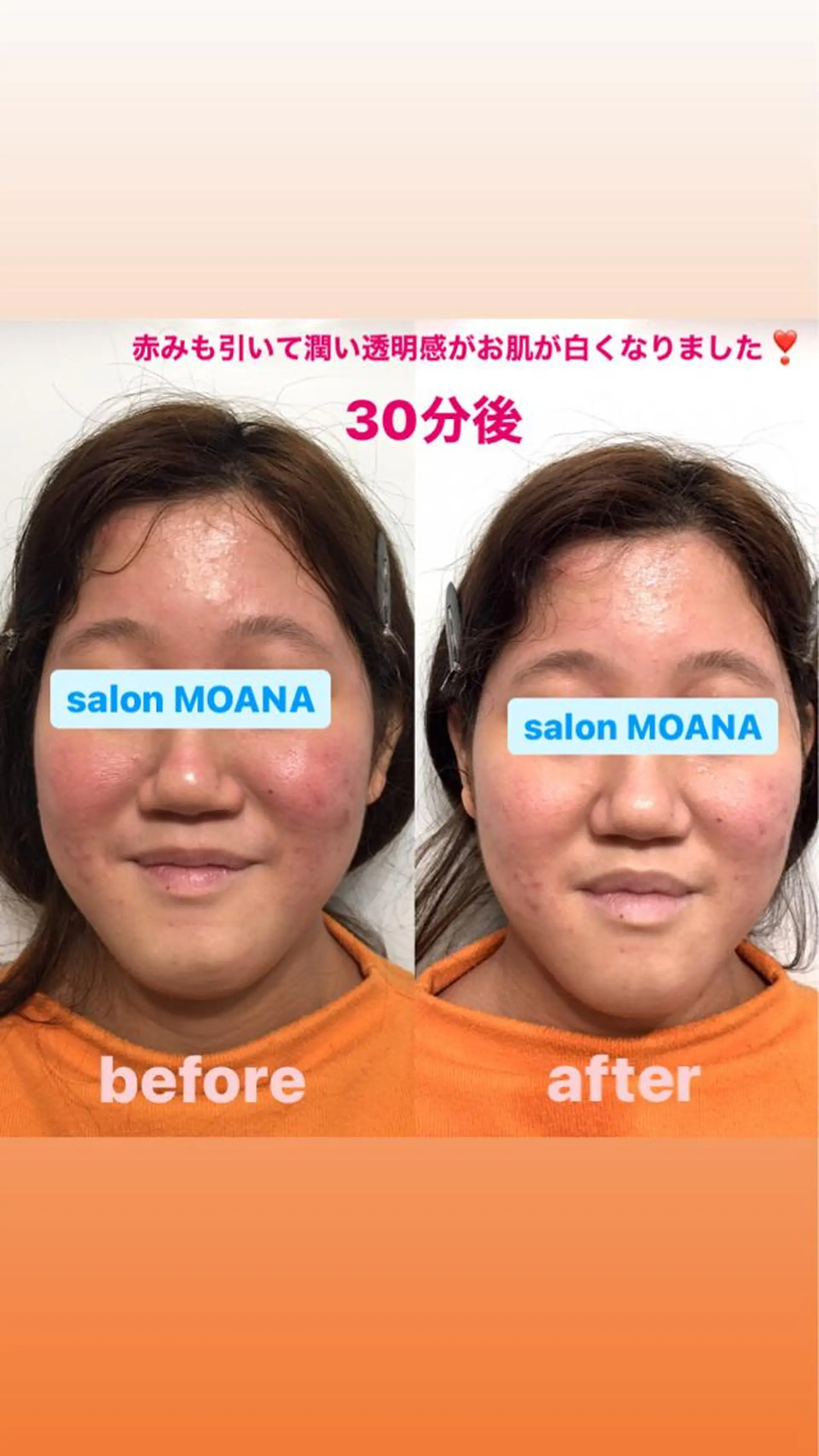 エステ 小顔美肌salon MOANAのエステ・リラクイメージ