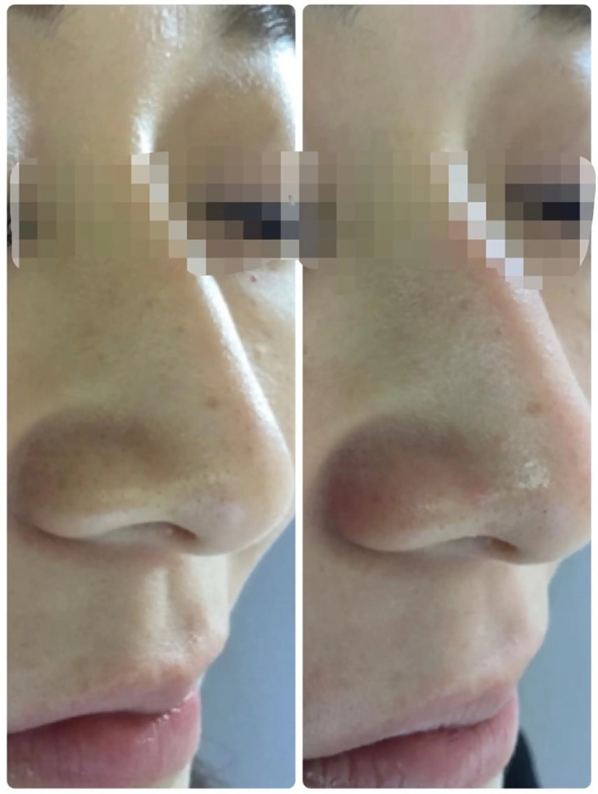 肌質改善サロンChouChou所属・肌質改善サロン chouchouのエステ・リラクイメージ