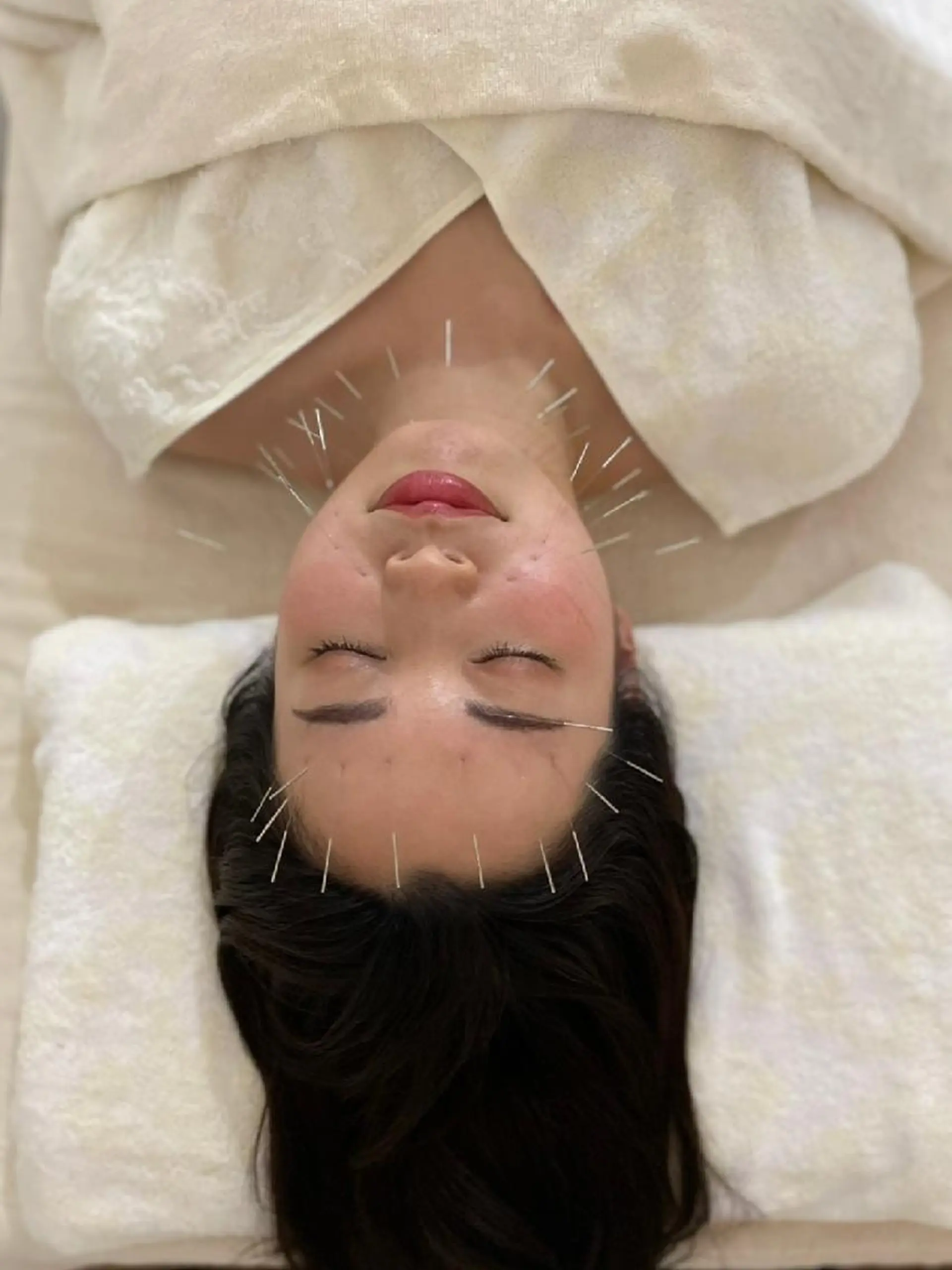 Brilo（ブリーロ）美容鍼灸サロン所属・💙美容鍼💙美顔矯 正🧡Brilo🧡のエステ・リラクイメージ