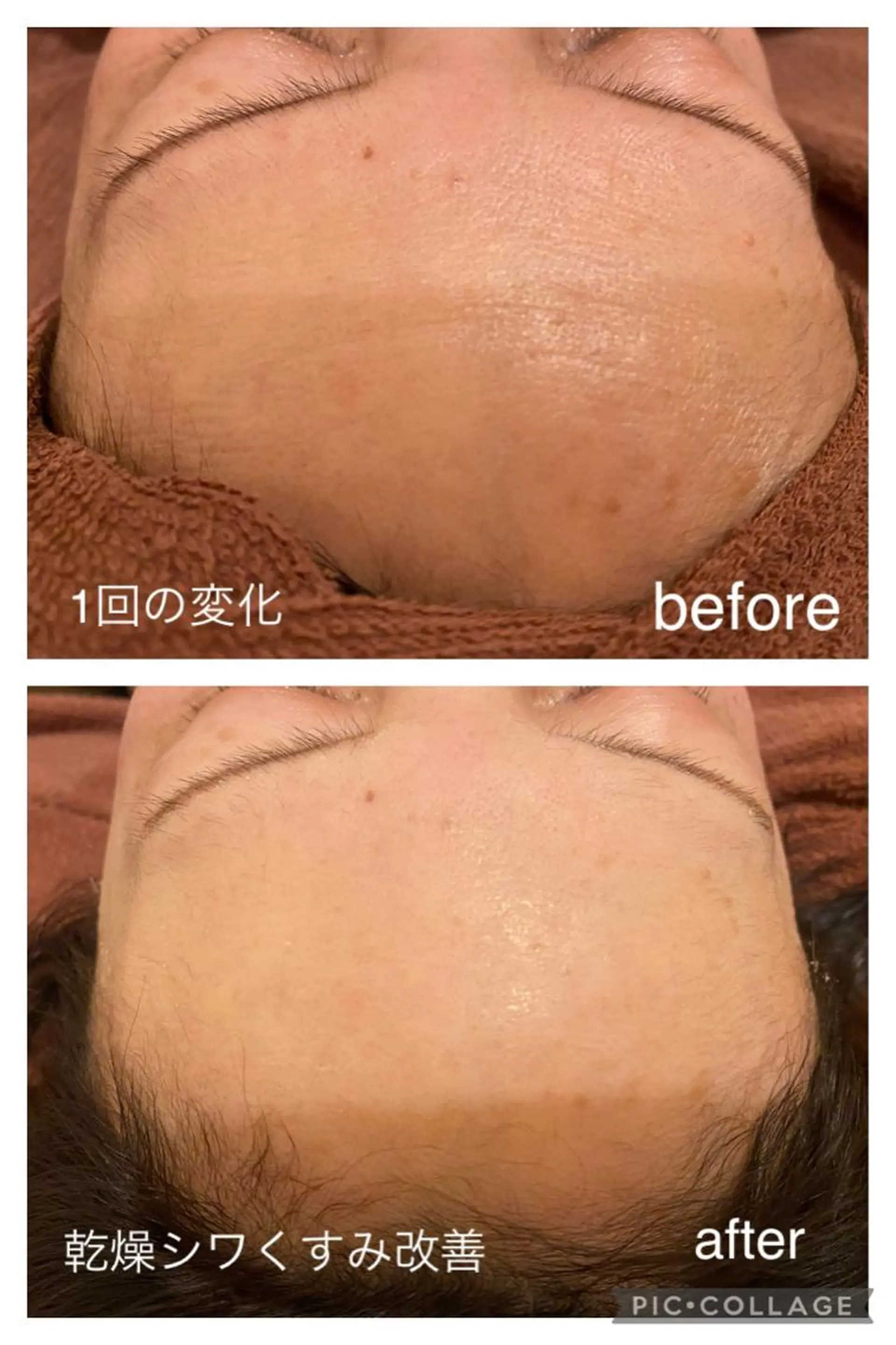 夏までに肌荒れ卒業 するサロン🌻のエステ・リラクイメージ