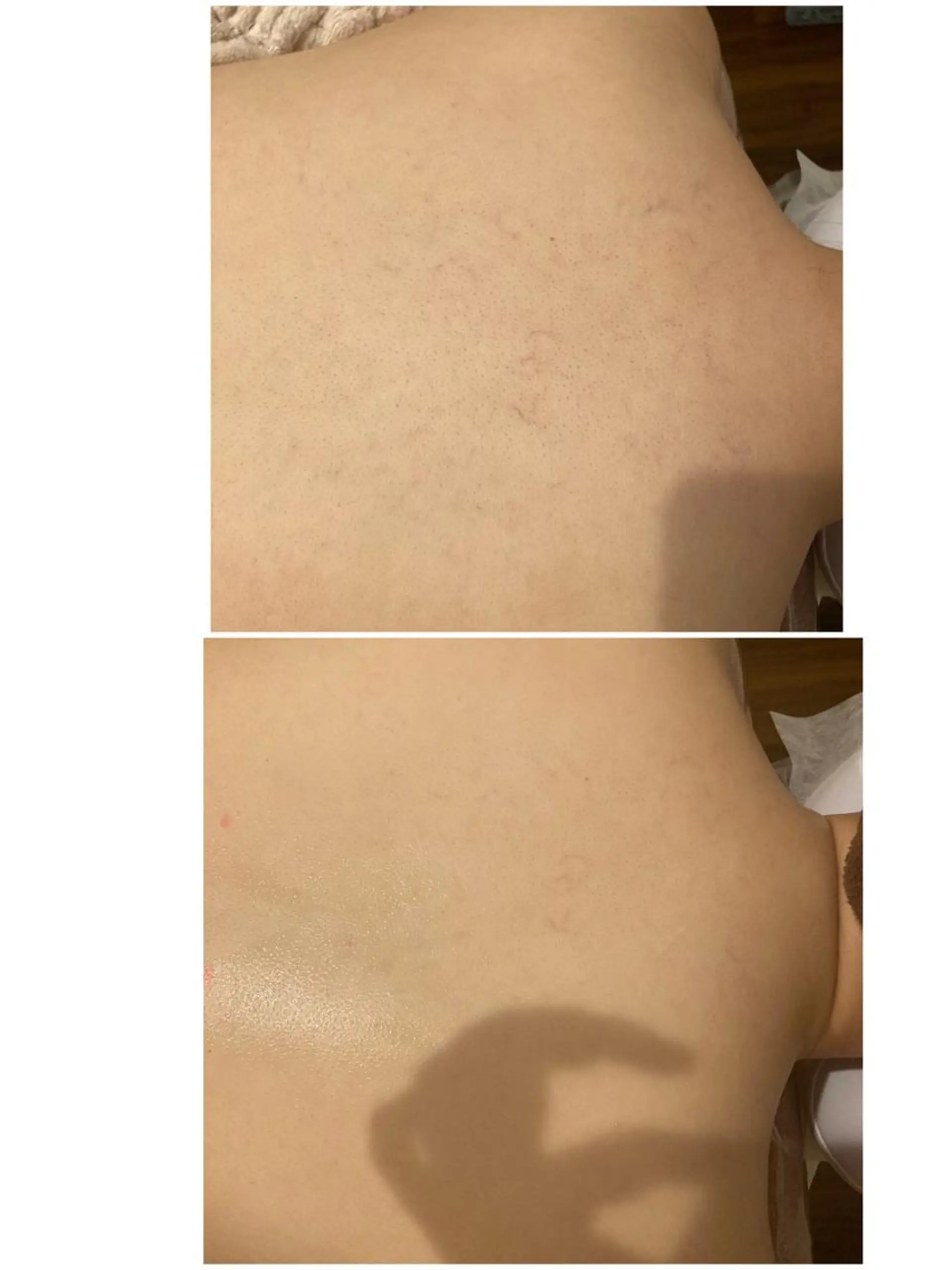 脱毛 ULULU上野店所属・ULULU 上野店のエステ・リラクイメージ