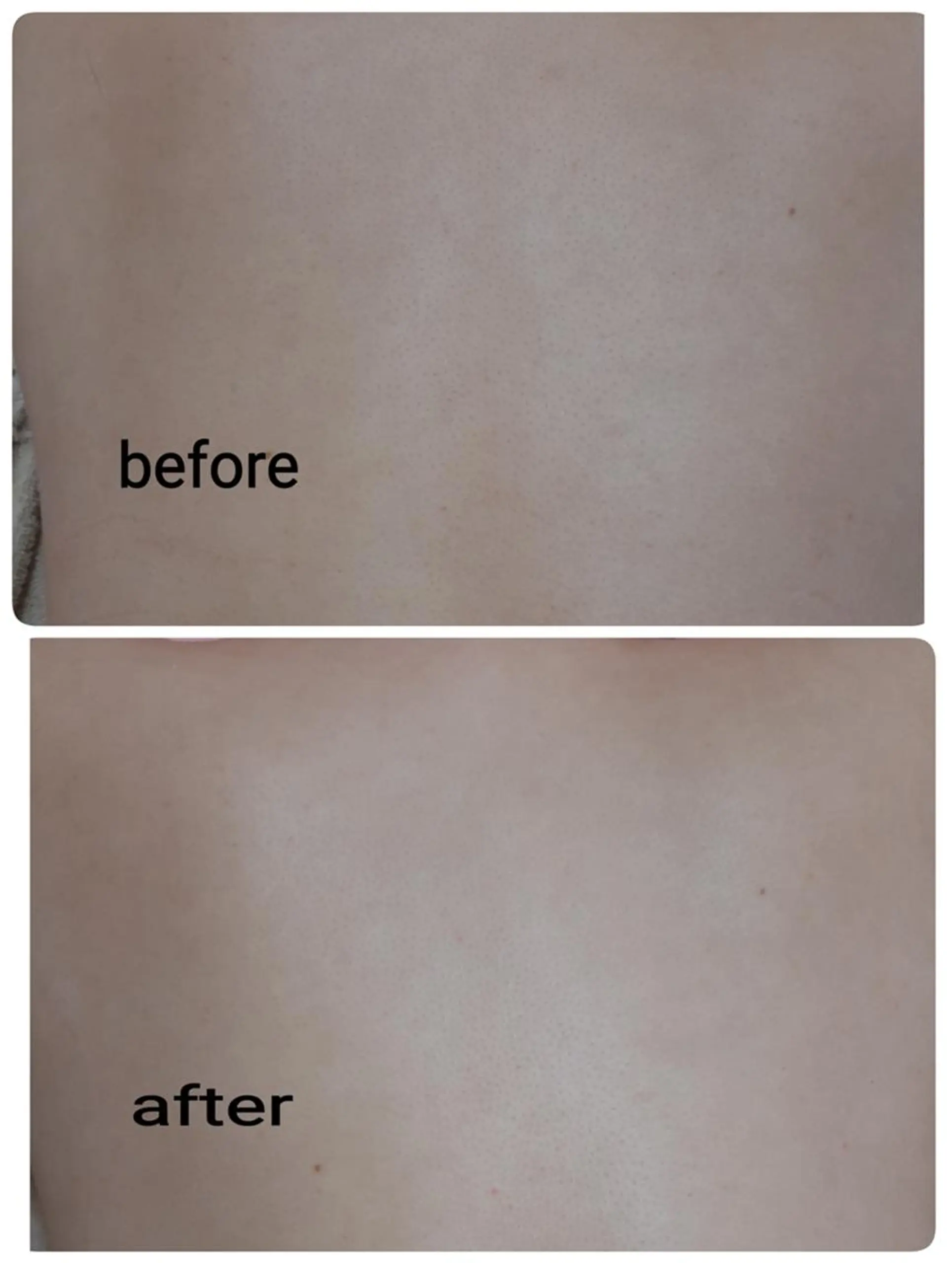 肌ケア＆毛穴洗浄 Cheriのエステ・リラクイメージ