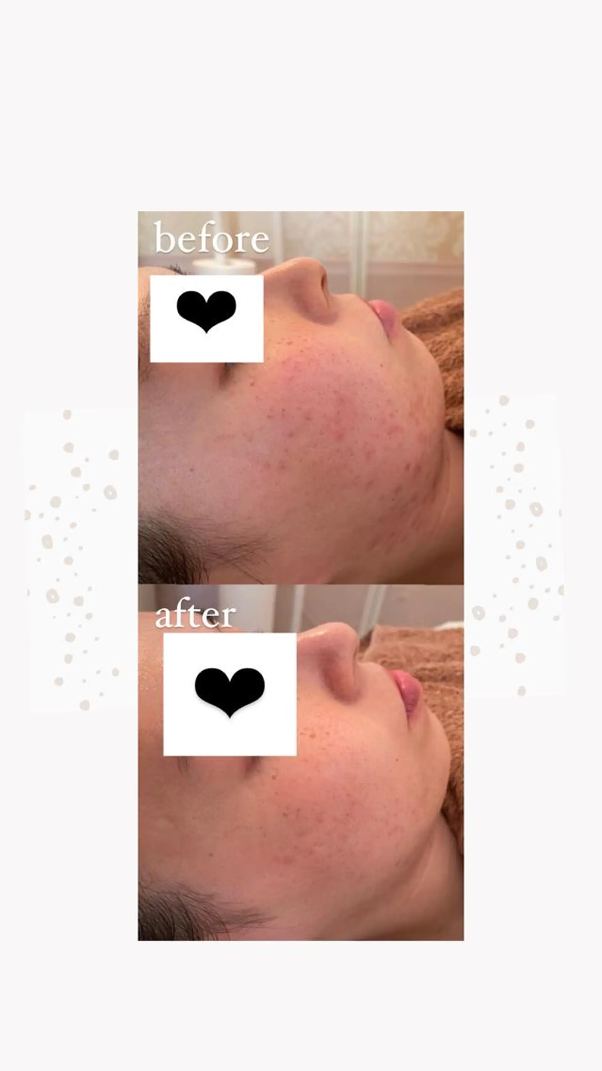 KOHAKU.所属・Nana Kikutaのエステ・リラクイメージ