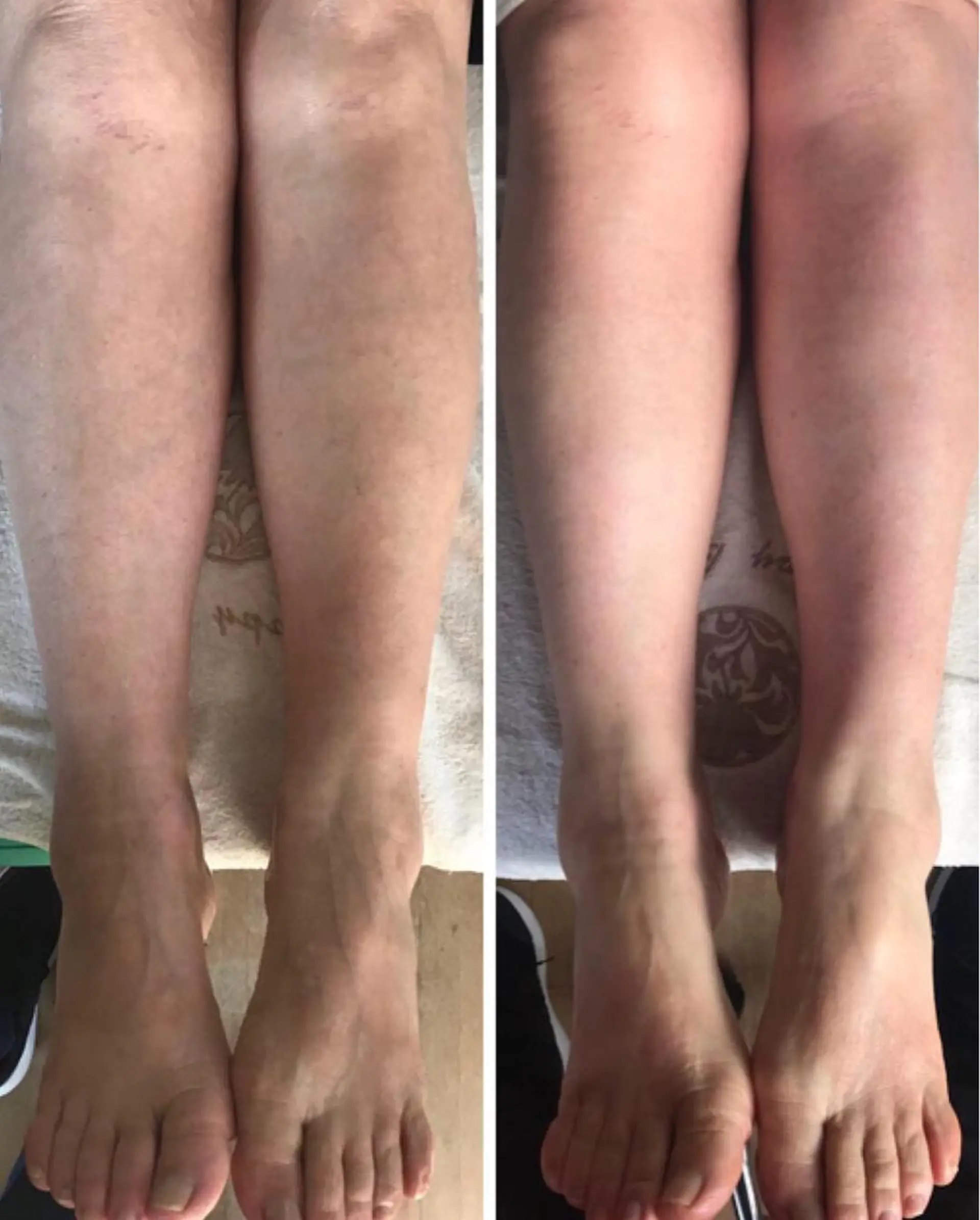 リンパとデトックス LAFUFUのエステ・リラクイメージ