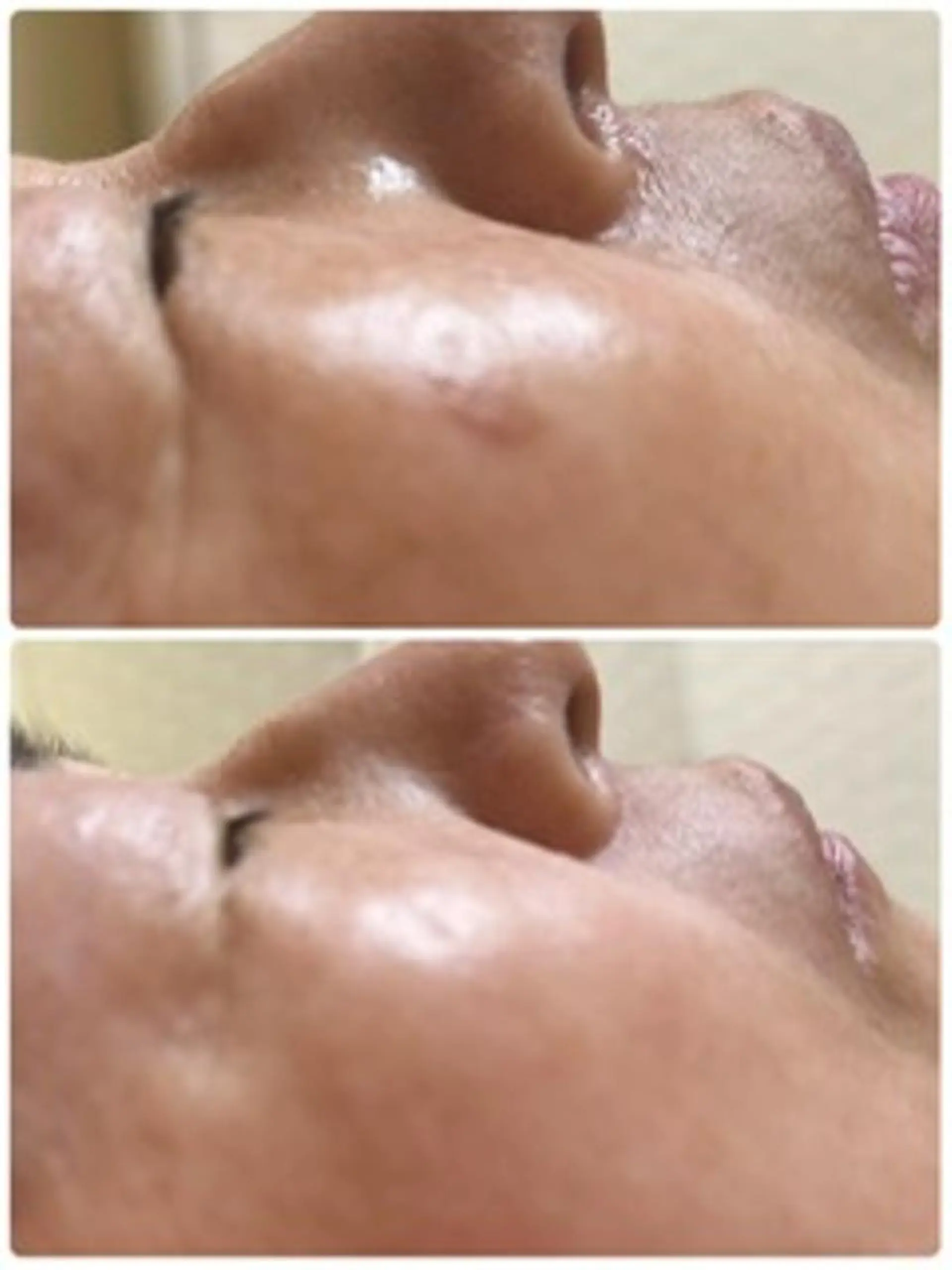 Lien オーナー　山口智嘉のエステ・リラクイメージ