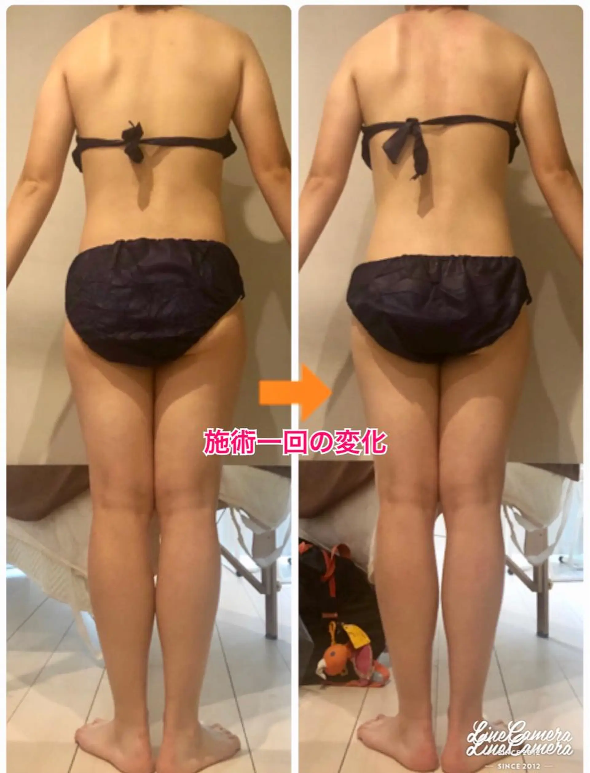 ロング カラー パーマ ヘアアレンジ メンズ キッズ ネイル マツエク・マツパ ‍痩身＆ボディ 結果出し🌟丹野のエステ・リラクイメージ