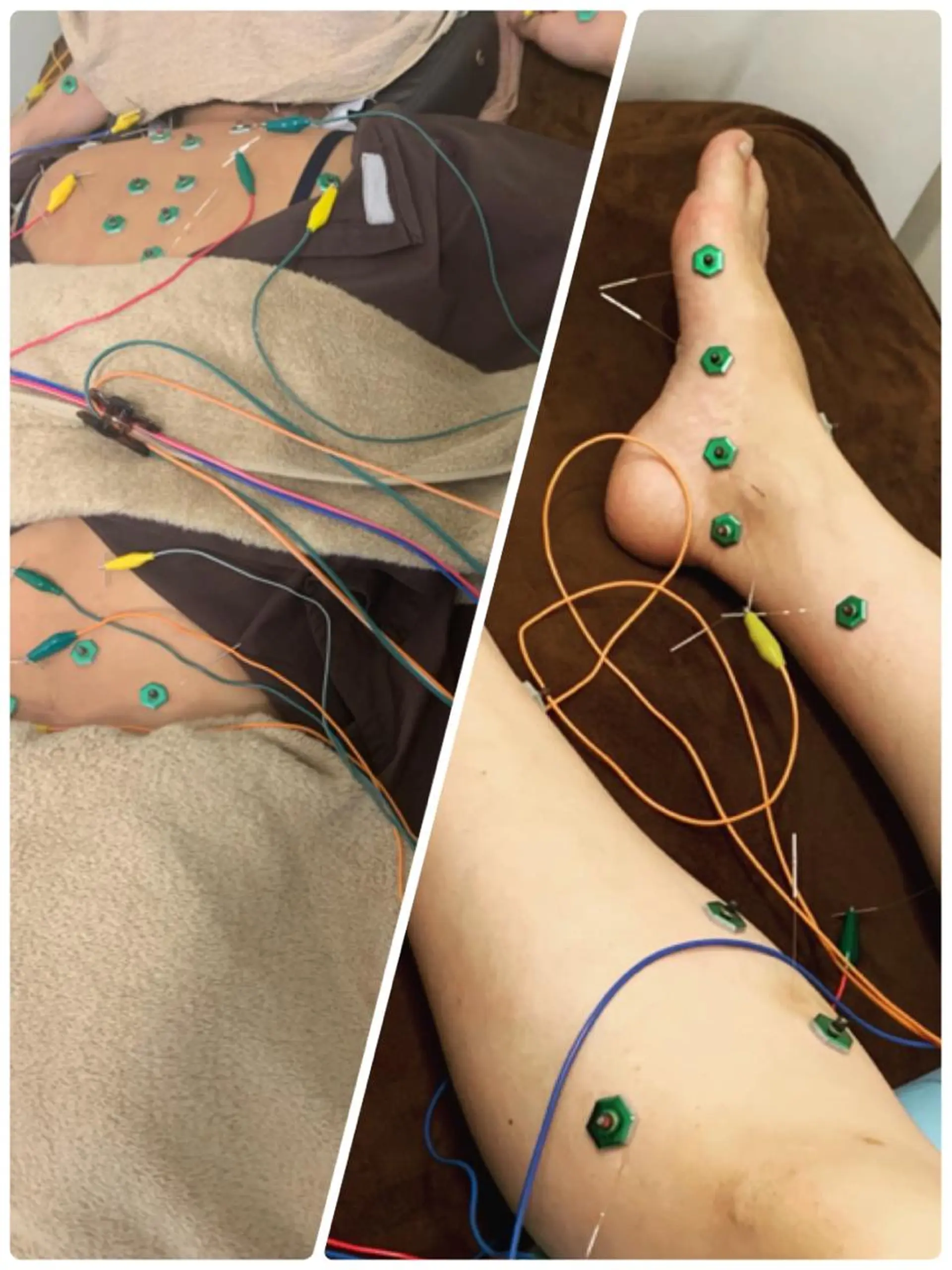 表参道鍼灸院K 美容鍼🔮ララピールのエステ・リラクイメージ