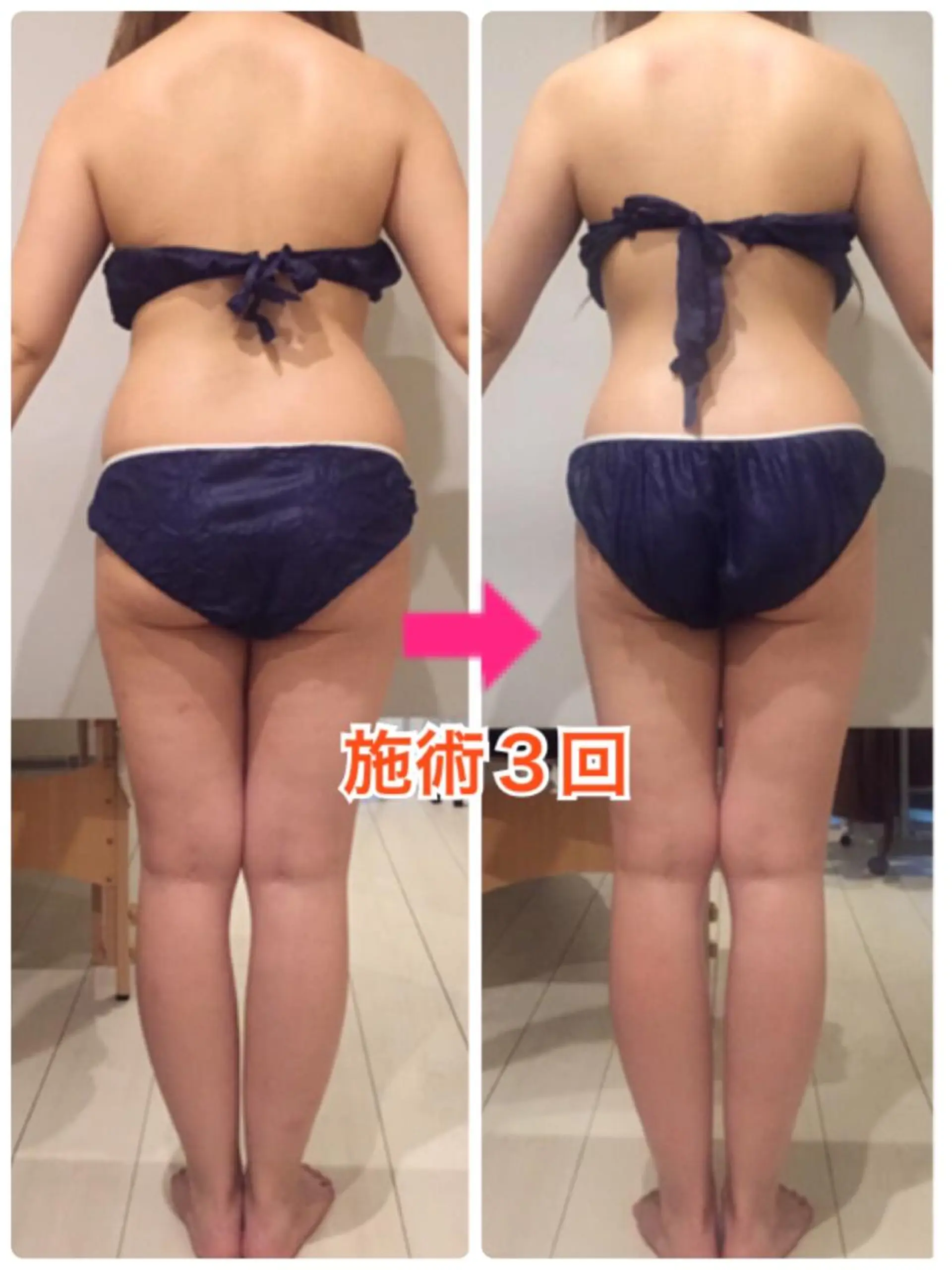 ショート カラー パーマ ヘアアレンジ メンズ キッズ ネイル マツエク・マツパ ‍痩身＆ボディ 結果出し🌟丹野のエステ・リラクイメージ