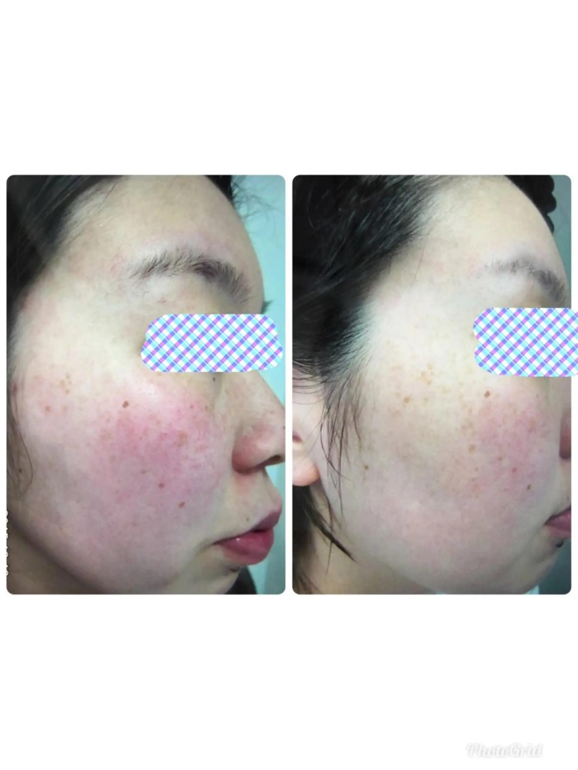 Facial stylist salon伊勢崎所属・中島 有希のエステ・リラクイメージ