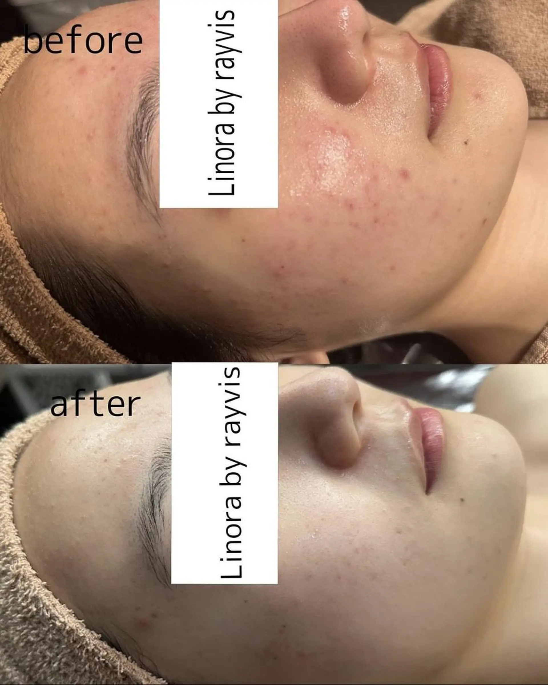 👑Linolaby RAYVIS👑⭐️のエステ・リラクイメージ