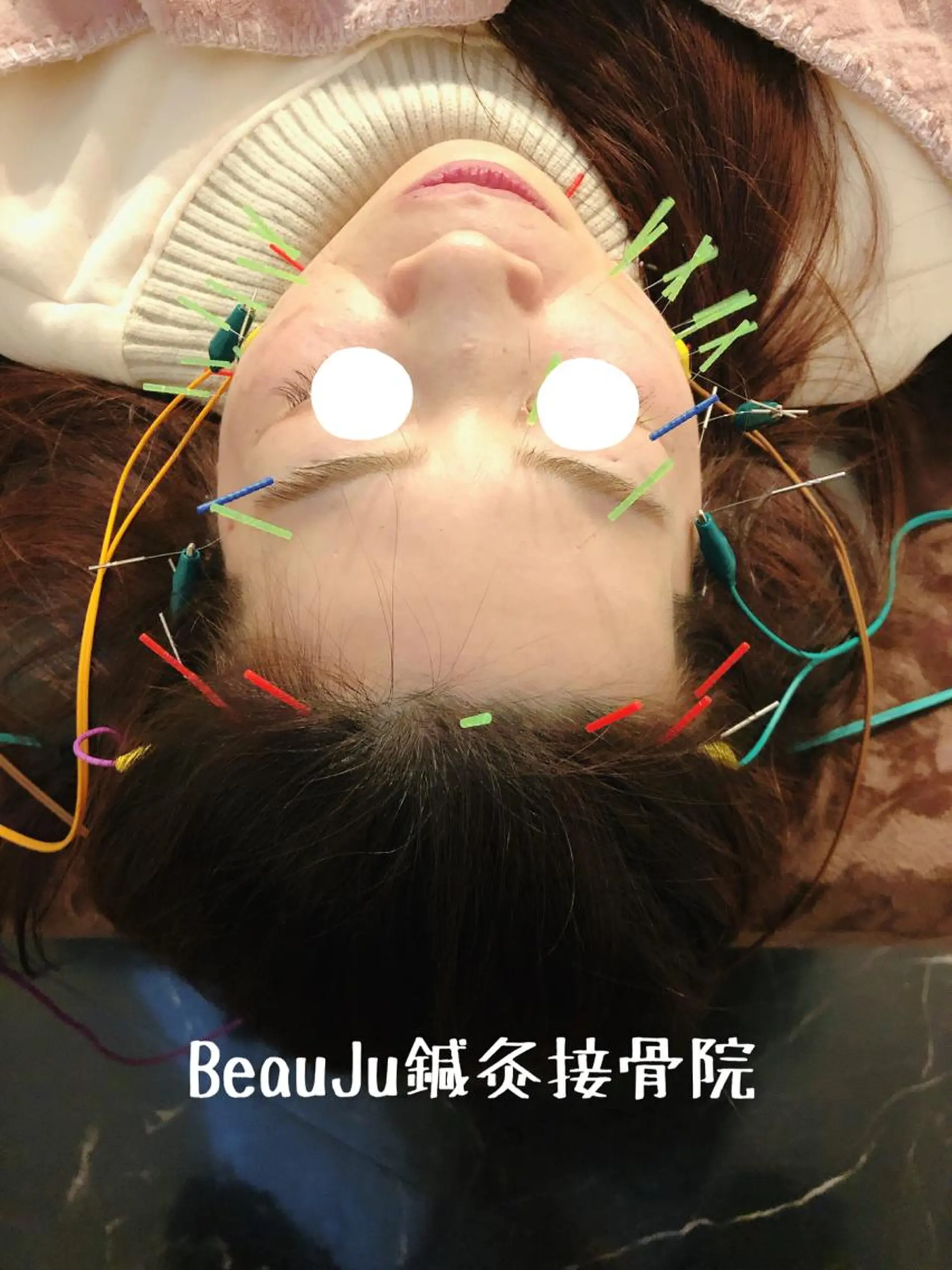 美容鍼灸整体サロンBeauJu所属・小顔矯/美容鍼/鍼灸 BeauJuのその他イメージ