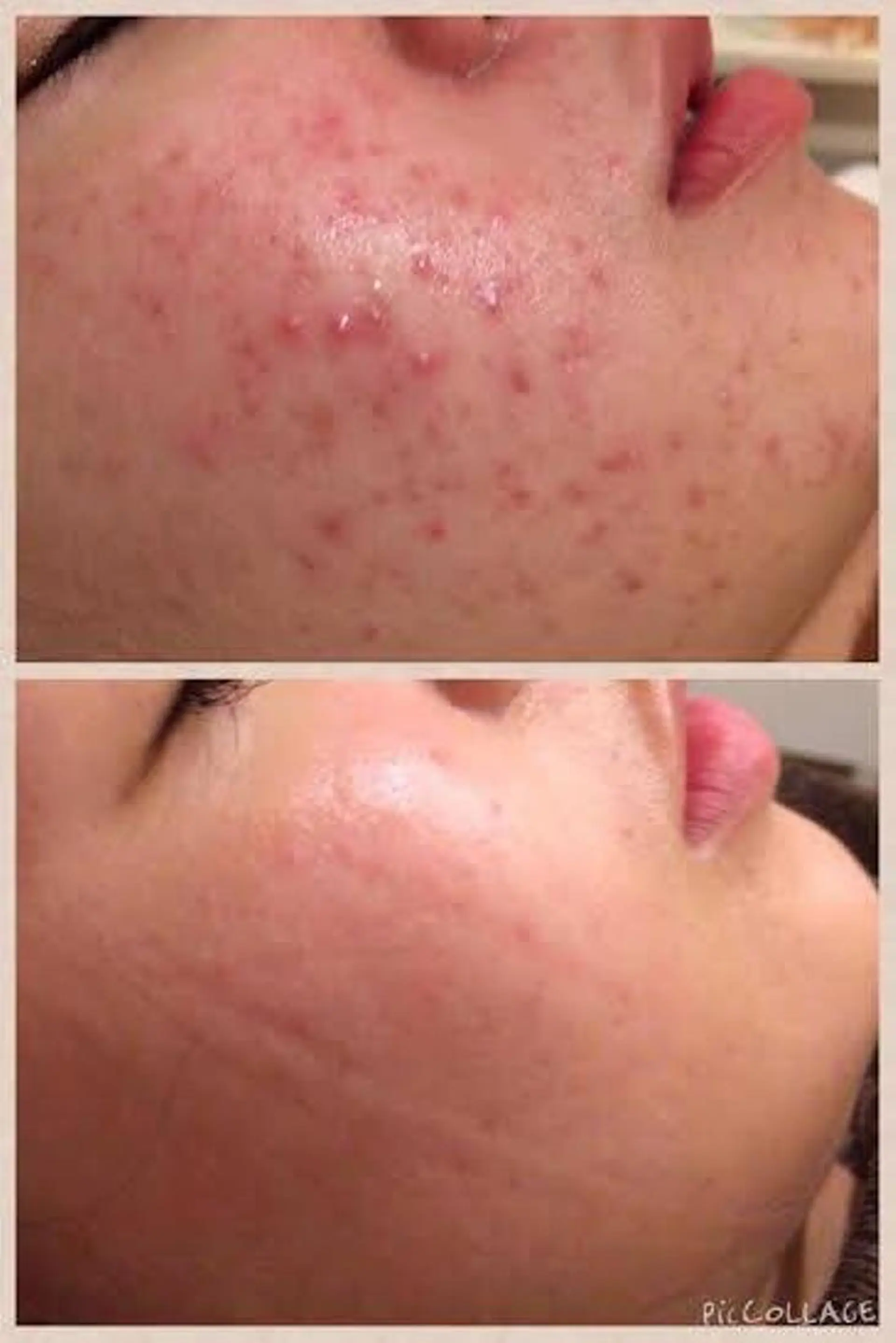 エステ merveilles所属・まつげ/整体/にきび ・アトピー専門サロンのマツエク・マツパデザイン