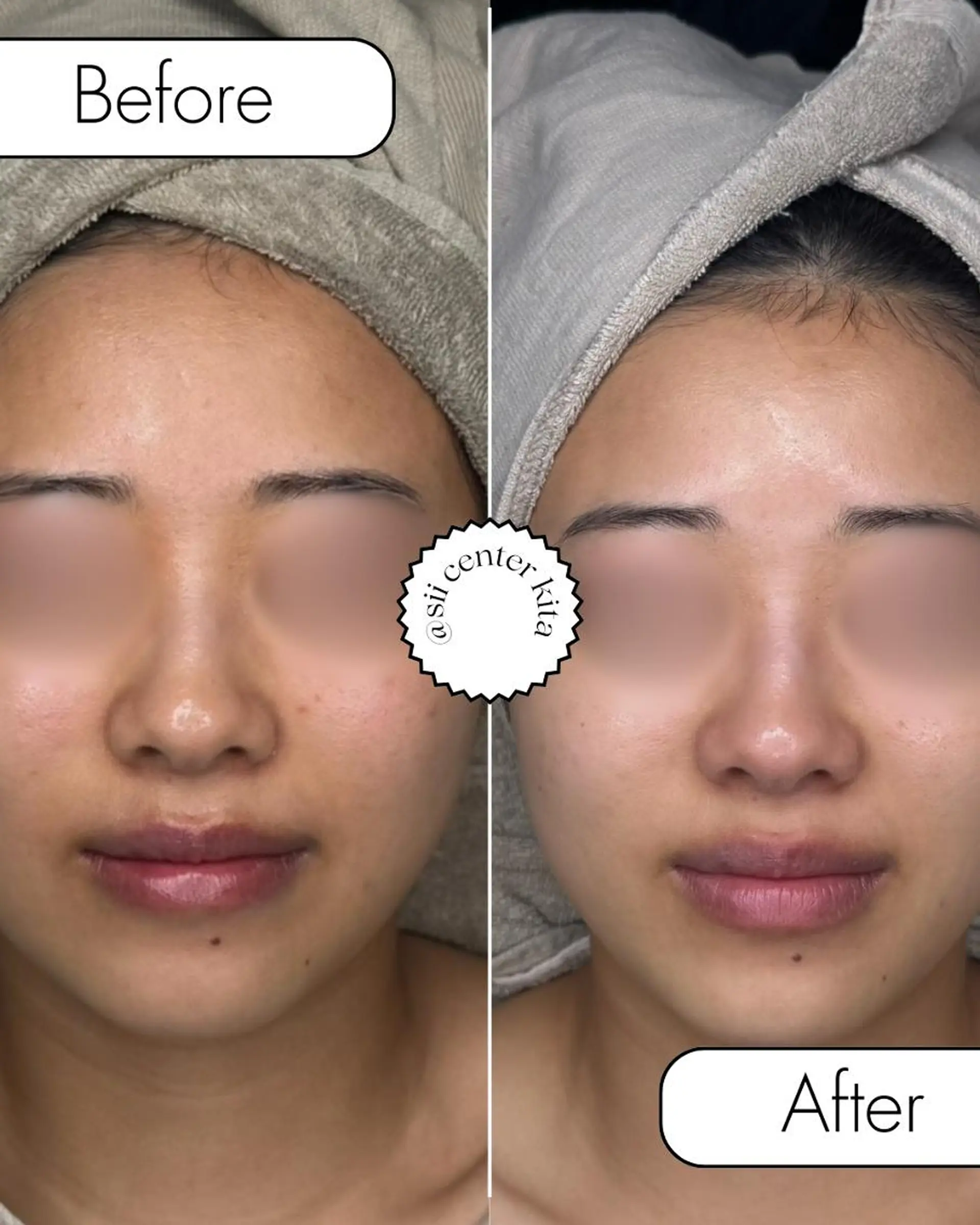 sii MIUのエステ・リラクイメージ