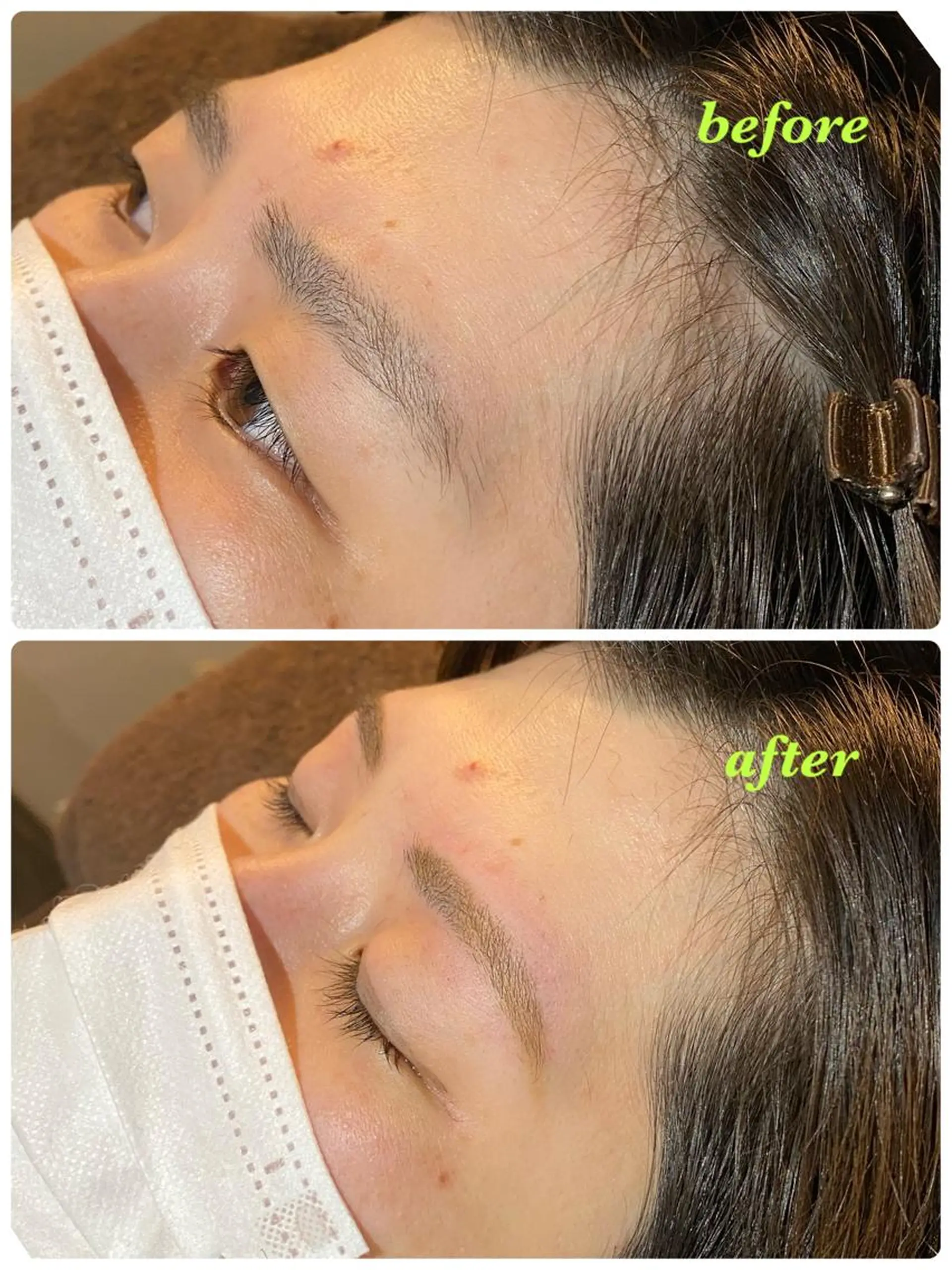 アイブロウ ハーブピーリング/韓国肌管理/フェイシャル/毛穴洗浄/眉毛/顔脱毛【糸脱毛専門】rev所属・ハーブピーリング🌹 毛穴洗浄❤️眉waxのエステ・リラクイメージ